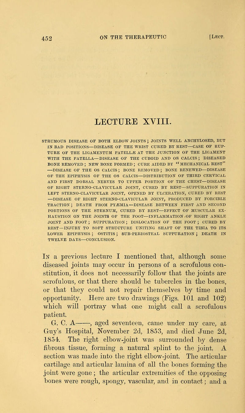 LECTURE XVIII. STRUMOUS DISEASE OP BOTH ELBOW JOINTS ; JOINTS WELL ANCHYLOSED, BUT IN BAD POSITIONS—DISEASE OF THE WRIST CURED BY REST—CASE OF RUP- TURE OF THE LIGAMENTUM PATELLA AT THE JUNCTION OF THE LIGAMENT WITH THE PATELLA—DISEASE OF THE CUBOID AND OS CALCIS ; DISEASED BONE REMOVED ; NEW BONE FORMED ; CURE AIDED BY MECHANICAL REST —DISEASE OF THE OS CALCIS ; BONE REMOVED ; BONE RENEWED—DISEASE OF THE EPIPHYSIS OF THE OS CALCIS—DISTRIBUTION OF THIRD CERVICAL AND FHtST DORSAL NERVES TO UPPER PORTION OF THE CHEST—DISEASE OF RIGHT STERNO-CLAVICULAR JOINT, CURED BY REST—SUPPURATION IN LEFT STERNO-CLAVICULAR JOINT, OPENED BY ULCERATION, CURED BY REST —DISEASE OF RIGHT STERNO-CLAVICULAR JOINT, PRODUCED BY FORCIBLE TRACTION ; DEATH FROM PYEMIA—DISEASE BETWEEN FIRST AND SECOND PORTIONS OF THE STERNUM, CURED BY REST—EFFECT OF MUSCULAR EX- HAUSTION ON THE JOINTS OF THE FOOT—INFLAMMATION-OF RIGHT ANKLE JOINT AND FOOT ; SUPPURATION; DISLOCATION OF THE FOOT ; CURED BY REST—INJURY TO SOFT STRUCTURE UNITING SHAFT OF THE TIBIA TO ITS LOWER EPIPHYSIS ; OSTITIS ; SUB-PERIOSTEAL SUPPURATION J DEATH IN TWELVE DAYS—CONCLUSION. In a previous lecture I mentioned that, although some diseased joints may occur in persons of a scrofulous con- stitution, it does not necessarily follow that the joints are scrofulous, or that there should he tubercles in the bones, or that they could not repair themselves by time and opportunity. Here are two drawings (Figs. 101 and 102) which will portray what one might call a scrofulous patient. G-. C. A , aged seventeen, came under my care, at G-uy's Hospital, November 2d, 1853, and died June 2d, 1854. The right elbow-joint was surrounded by dense fibrous tissue, forming a natural splint to the joint. A section was made into the right elbow-joint. The articular cartilage and articular lamina of all the bones forming the joint were gone ; the articular extremities of the opposing bones were rough, spongy, vascular, and in contact; and a