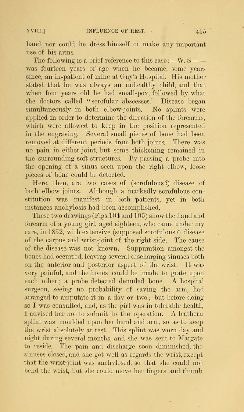 Land, nor could he dress himself or make any important use of his arms. The following is a brief reference to this case:—W. S was fourteen years of age when he became, some years since, an in-patient of mine at Guy's Hospital. His mother stated that he was always an unhealthy child, and that when four years old he had small-pox, followed by what the doctors called scrofular abscesses. Disease began simultaneously in both elbow-joints. No splints were applied in order to determine the direction of the forearms, which were allowed to keep in the position represented in the engraving. Several small pieces of bone had been removed at different periods from both joints. There was no pain in either joint, but some thickening remained in the surrounding soft structures. By passing a probe into the opening of a sinus seen upon the right elbow, loose pieces of bone could be detected. Here, then, are two cases of (scrofulous?) disease of both elbow-joints. Although a markedly scrofulous con- stitution was manifest in both patients, yet in both instances anchylosis had been accomplished. These two drawings (Figs. 104 and 105) show the hand and forearm of a young girl, aged eighteen, who came under my care, in 1852, with extensive (supposed scrofulous ?) disease of the carpus and wrist-joint of the right side. The cause of the disease was not known. Suppuration amongst the bones had occurred, leaving several discharging sinuses both on the anterior and posterior aspect of the wrist. It was very painful, and the bones could be made to grate upon each other; a probe detected denuded bone. A hospital surgeon, seeing no probability of saving the arm, had arranged to amputate it in a day or two; but before doing so I was consulted, and, as the girl was in tolerable health, I advised her not to submit to the operation. A leathern splint was moulded upon her hand and arm, so as to keep the wrist absolutely at rest. This splint was worn day and night during several months, and she was sent to Margate to reside. The pain and discharge soon diminished, the sinuses closed, and she got well as regards the wrist, except that the wrist-joint was anchylosed, so that she could not bend the wrist, but she could move her fingers and thumb