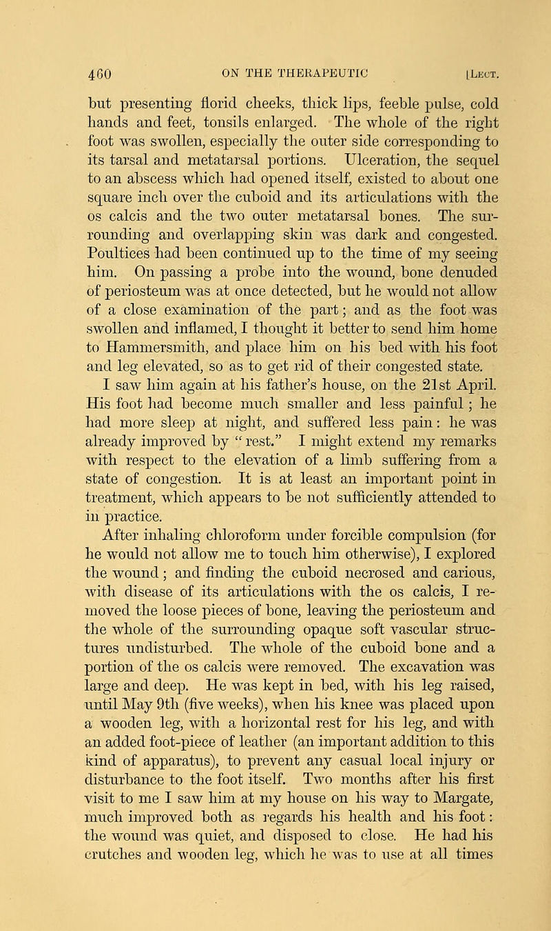 but presenting florid cheeks, thick lips, feeble pulse, cold hands and feet, tonsils enlarged. The whole of the right foot was swollen, especially the outer side corresponding to its tarsal and metatarsal portions. Ulceration, the sequel to an abscess which had opened itself, existed to about one square inch over the cuboid and its articulations with the os calcis and the two outer metatarsal bones. The sur- rounding and overlapping skin was dark and congested. Poultices had been continued up to the time of my seeing him. On passing a probe into the wound, bone denuded of periosteum was at once detected, but he would not allow of a close examination of the part; and as the foot was swollen and inflamed, I thought it better to send him home to Hammersmith, and place him on his bed with his foot and leg elevated, so as to get rid of their congested state. I saw him again at his father's house, on the 21st April. His foot had become much smaller and less painful; he had more sleep at night, and suffered less pain: he was already improved by  rest. I might extend my remarks with respect to the elevation of a limb suffering from a state of congestion. It is at least an important point in treatment, which appears to be not sufficiently attended to in practice. After inhaling chloroform under forcible compulsion (for he would not allow me to touch him otherwise), I explored the wound; and finding the cuboid necrosed and carious, with disease of its articulations with the os calcis, I re- moved the loose pieces of bone, leaving the periosteum and the whole of the surrounding opaque soft vascular struc- tures undisturbed. The whole of the cuboid bone and a portion of the os calcis were removed. The excavation was large and deep. He was kept in bed, with his leg raised, until May 9th (five weeks), when his knee was placed upon a wooden leg, with a horizontal rest for his leg, and with an added foot-piece of leather (an important addition to this kind of apparatus), to prevent any casual local injury or disturbance to the foot itself. Two months after his first visit to me I saw him at my house on his way to Margate, much improved both as regards his health and his foot: the wound was quiet, and disposed to close. He had his crutches and wooden leg, which he was to use at all times