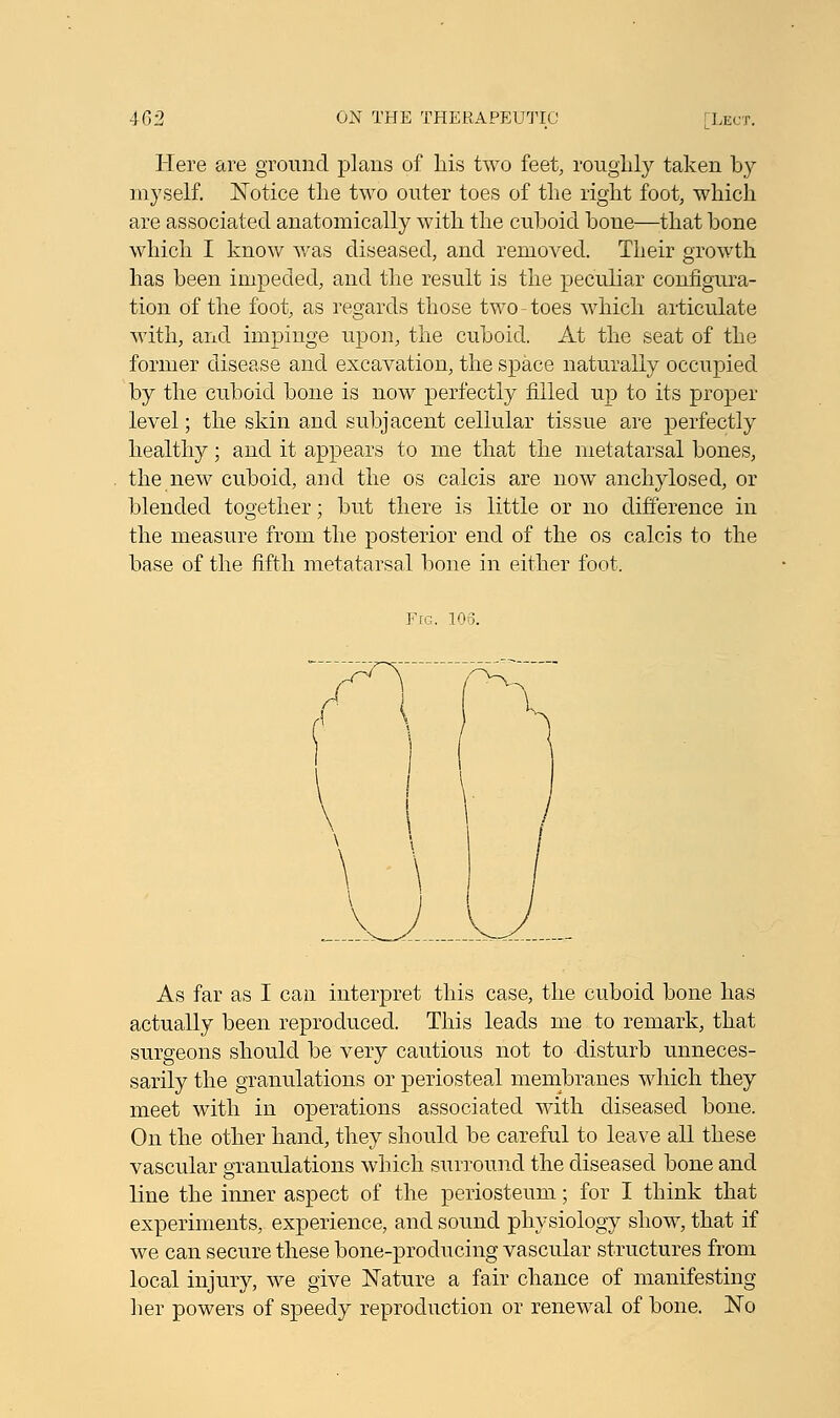 Here are ground plans of his two feet, roughly taken by myself. Notice the two outer toes of the right foot, which are associated anatomically with the cuboid bone—that bone which I know was diseased, and removed. Their growth has been impeded, and the result is the peculiar configura- tion of the foot, as regards those two-toes which articulate with, and impinge upon, the cuboid. At the seat of the former disease and excavation, the space naturally occupied by the cuboid bone is now perfectly rilled up to its proper level; the skin and subjacent cellular tissue are perfectly healthy; and it appears to me that the metatarsal bones, the new cuboid, and the os calcis are now anchylosed, or blended together; but there is little or no difference in the measure from the posterior end of the os calcis to the base of the fifth metatarsal bone in either foot. Fig, 106. ^H ~ I \ \ VJ. As far as I can interpret this case, the cuboid bone has actually been reproduced. This leads me to remark, that surgeons should be very cautious not to disturb unneces- sarily the granulations or periosteal membranes which they meet with in operations associated with diseased bone. On the other hand, they should be careful to leave all these vascular granulations which surround the diseased bone and line the inner aspect of the periosteum; for I think that experiments, experience, and sound physiology show, that if we can secure these bone-producing vascular structures from local injury, we give Nature a fair chance of manifesting her powers of speedy reproduction or renewal of bone. No