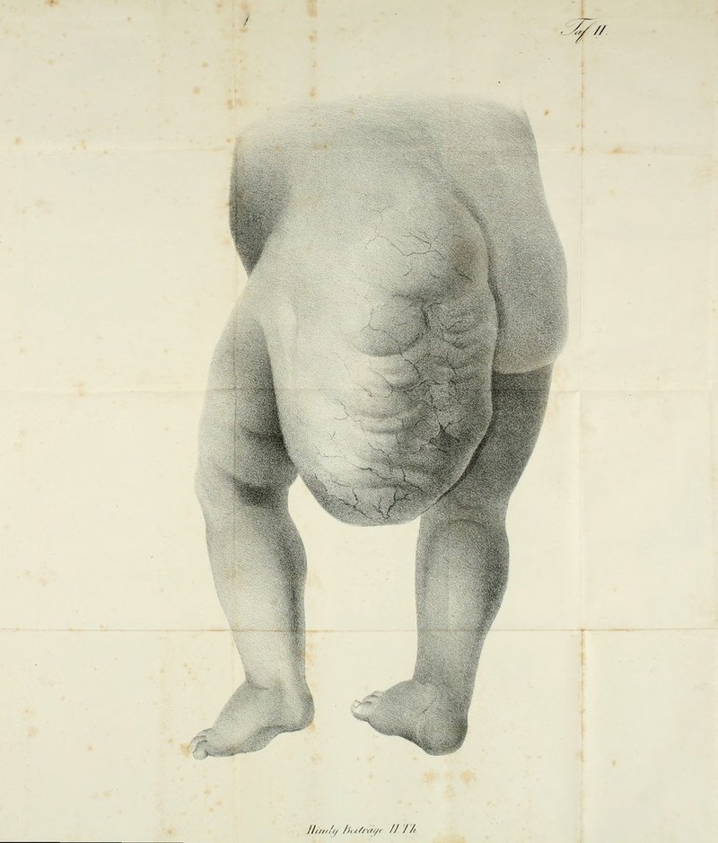 ■-¥■ // ll//li'l/ /i,///-ilr/i /l / /l