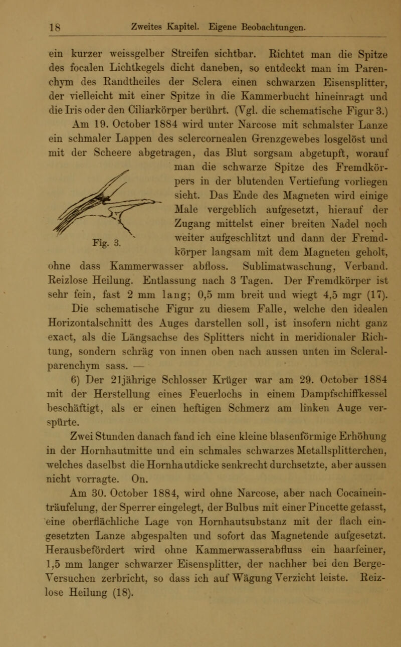 ein kurzer weissgelber Streifen sichtbar. Eichtet man die Spitze des focalen Lichtkegels dicht daneben, so entdeckt man im Paren- ehyni des Eandtheiles der Sclera einen schwarzen Eisensplitter, der vielleicht mit einer Spitze in die Kamnierbucht hineinragt und die Iris oder den Ciliarkörper berührt. (Vgl. die schematische Figur 3.) Am 19. October 18S4 wird unter Xarcose mit schmälster Lanze ein schmaler Lappen des sclercornealen Grenzgewebes losgelöst und mit der Scheere abgetragen, das Blut sorgsam abgetupft, worauf man die schwarze Spitze des Fremdkör- pers in der blutenden Vertiefung vorliegen sieht. Das Ende des Magneten wird einige Male vergeblich aufgesetzt, hierauf der Zugang mittelst einer breiten Nadel noch weiter aufgeschlitzt und dann der Fremd- körper langsam mit dem Magneten geholt, ohne dass Kammerwasser abfloss. Sublimatwaschung, Verband. Reizlose Heilung. Entlassung nach 3 Tagen. Der Fremdkörper ist sehr fein, fast 2 mm lang; 0,5 mm breit und wiegt 4.5 mgr (17). Die schematische Figur zu diesem Falle, wrelche den idealen Horizontalschnitt des Auges darstellen soll, ist insofern nicht ganz exact, als die Längsachse des Splitters nicht in meridionaler Rich- tung, sondern schräg von innen oben nach aussen unten im Scleral- parenchym sass. — 6) Der 21jährige Schlosser Krüger war am 29. October 1884 mit der Herstellung eines Feuerlochs in einem Dampfschiffkessel beschäftigt, als er einen heftigen Schmerz am linken Auge ver- spürte. Zwei Stunden danach fand ich eine kleine blasenförmige Erhöhung in der Hornhautmitte und ein schmales sclrwarzes Metallsplitterchen, welches daselbst die Hornhautdicke senkrecht durchsetzte, aber aussen nicht vorragte. On. Am 30. October 1884, wird ohne Xarcose, aber nach Cocainein- träufelung, der Sperrer eingelegt, der Bulbus mit einer Pincette gelasst, eine oberflächliche Lage von Hornhautsubstanz mit der flach ein- gesetzten Lanze abgespalten und sofort das Magnetende aufgesetzt. Herausbefördert wird ohne Kammerwasserabfluss ein haarfeiner, 1,5 mm langer schwarzer Eisensplitter, der nachher bei den Berge- Versuchen zerbricht, so dass ich auf Wägung Verzicht leiste. Reiz- lose Heilung (18).