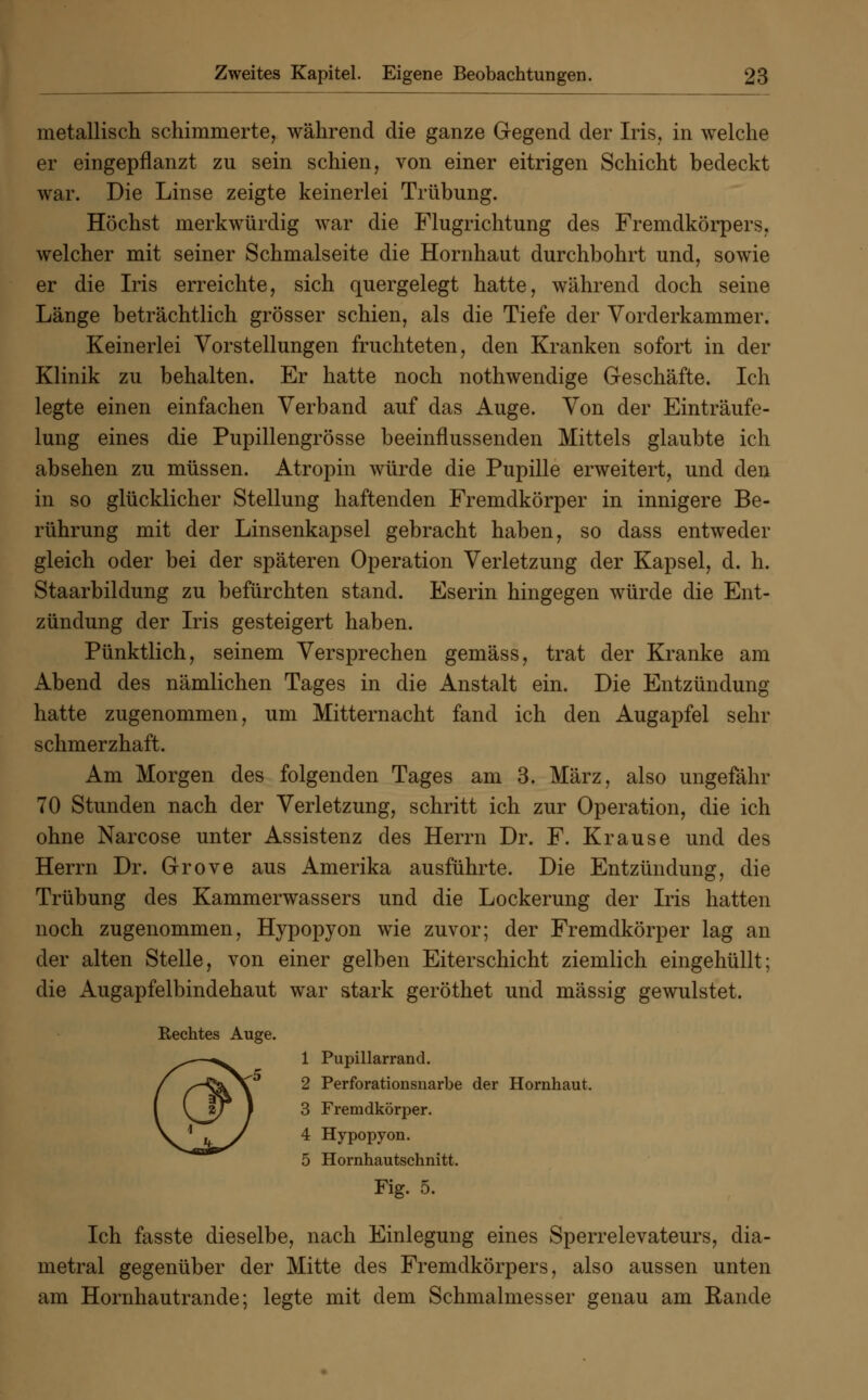 metallisch schimmerte, während die ganze Gegend der Iris, in welche er eingepflanzt zu sein schien, von einer eitrigen Schicht bedeckt war. Die Linse zeigte keinerlei Trübung. Höchst merkwürdig war die Flugrichtung des Fremdkörpers, welcher mit seiner Schmalseite die Hornhaut durchbohrt und, sowie er die Iris erreichte, sich quergelegt hatte, während doch seine Länge beträchtlich grösser schien, als die Tiefe der Vorderkammer. Keinerlei Vorstellungen fruchteten, den Kranken sofort in der Klinik zu behalten. Er hatte noch nothwendige Geschäfte. Ich legte einen einfachen Verband auf das Auge. Von der Einträufe- lung eines die Pupillengrösse beeinflussenden Mittels glaubte ich absehen zu müssen. Atropin würde die Pupille erweitert, und den in so glücklicher Stellung haftenden Fremdkörper in innigere Be- rührung mit der Linsenkapsel gebracht haben, so dass entweder gleich oder bei der späteren Operation Verletzung der Kapsel, d. h. Staarbildung zu befürchten stand. Eserin hingegen würde die Ent- zündung der Iris gesteigert haben. Pünktlich, seinem Versprechen gemäss, trat der Kranke am Abend des nämlichen Tages in die Anstalt ein. Die Entzündung hatte zugenommen, um Mitternacht fand ich den Augapfel sehr schmerzhaft. Am Morgen des folgenden Tages am 3. März, also ungefähr 70 Stunden nach der Verletzung, schritt ich zur Operation, die ich ohne Narcose unter Assistenz des Herrn Dr. F. Krause und des Herrn Dr. Grove aus Amerika ausführte. Die Entzündung, die Trübung des Kammerwassers und die Lockerung der Iris hatten noch zugenommen, Hypopyon wie zuvor; der Fremdkörper lag an der alten Stelle, von einer gelben Eiterschicht ziemlich eingehüllt; die Augapfelbindehaut war stark geröthet und massig gewulstet. Rechtes Auge. 1 Pupillarrand. 2 Perforationsuarbe der Hornhaut. 3 Fremdkörper. 4 Hypopyon. 5 Hornhautschnitt. Fig. 5. Ich fasste dieselbe, nach Einlegung eines Sperrelevateurs, dia- metral gegenüber der Mitte des Fremdkörpers, also aussen unten am Hornhautrande; legte mit dem Schmalmesser genau am Rande