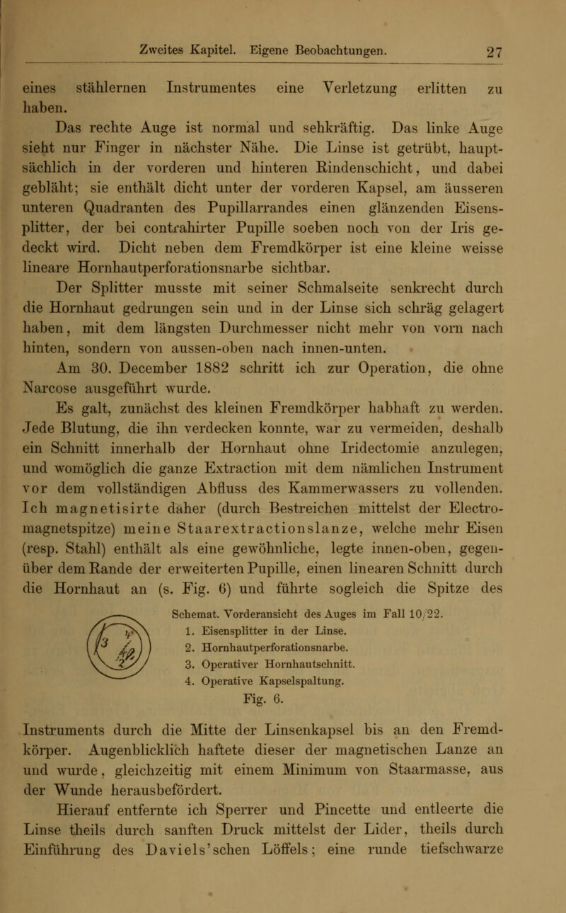 eines stählernen Instrumentes eine Verletzung erlitten zu haben. Das rechte Auge ist normal und sehkräftig. Das linke Auge sieht nur Finger in nächster Nähe. Die Linse ist getrübt, haupt- sächlich in der vorderen und hinteren Rindenschicht, und dabei gebläht; sie enthält dicht unter der vorderen Kapsel, am äusseren unteren Quadranten des Pupillarrandes einen glänzenden Eisens- plitter, der bei contrahirter Pupille soeben noch von der Iris ge- deckt wird. Dicht neben dem Fremdkörper ist eine kleine weisse lineare Hornhautperforationsnarbe sichtbar. Der Splitter musste mit seiner Schmalseite senkrecht durch die Hornhaut gedrungen sein und in der Linse sich schräg gelagert haben, mit dem längsten Durchmesser nicht mehr von vorn nach hinten, sondern von aussen-oben nach innen-unten. Am 30. December 1882 schritt ich zur Operation, die ohne Narcose ausgeführt wurde. Es galt, zunächst des kleinen Fremdkörper habhaft zu werden. Jede Blutung, die ihn verdecken konnte, war zu vermeiden, deshalb ein Schnitt innerhalb der Hornhaut ohne Iridectomie anzulegen, und womöglich die ganze Extraction mit dem nämlichen Instrument vor dem vollständigen Abfluss des Kammerwassers zu vollenden. Ich magnetisirte daher (durch Bestreichen mittelst der Electro- magnetspitze) meine Staarextractionslanze, welche mehr Eisen (resp. Stahl) enthält als eine gewöhnliche, legte innen-oben, gegen- über dem Rande der erweiterten Pupille, einen linearen Schnitt durch die Hornhaut an (s. Fig. 6) und führte sogleich die Spitze des Scheraat. Vorderansicht des Auges im Fall 10 22. 1. Eisensplitter in der Linse. 2. Hornhautperforationsnarbe. 3. Operativer Hornhautschnitt. 4. Operative Kapselspaltung. Fig. 6. Instruments durch die Mitte der Linsenkapsel bis an den Fremd- körper. Augenblicklich haftete dieser der magnetischen Lanze an und wurde, gleichzeitig mit einem Minimum von Staarmasse, aus der Wunde herausbefördert. Hierauf entfernte ich Sperrer und Pincette und entleerte die Linse theils durch sanften Druck mittelst der Lider, theils durch Einführung des Da vi eis 'sehen Löffels; eine runde tiefschwarze
