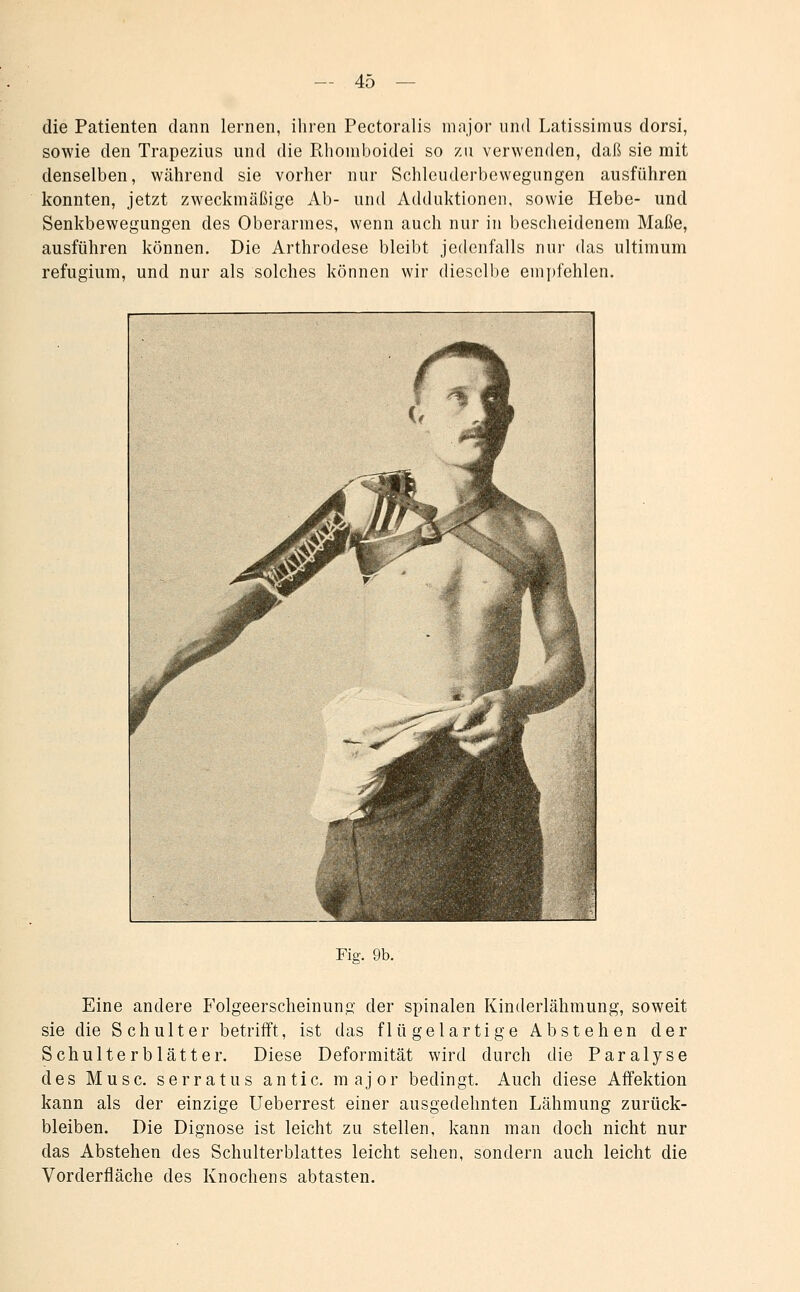 die Patienten dann lernen, ihren Pectoralis major und Latissimus dorsi, sowie den Trapezius und die Rhoniboidei so zu verwenden, daß sie mit denselben, während sie vorher nur Schlcuderbewegungen ausführen konnten, jetzt zweckmäßige Ab- und Adduktionen, sowie Hebe- und Senkbewegungen des Oberarmes, wenn auch nur in bescheidenem Maße, ausführen können. Die Arthrodese bleibt jedenfalls nur das ultimum refugium, und nur als solches können wir dieselbe em])fehlen. Fig. 9b. Eine andere Folgeerscheinung der spinalen Kinderlähmung, soweit sie die Schulter betrifft, ist das flügelartige Abstehen der Schulterblätter. Diese Deformität wird durch die Paralyse des Muse, serratus antic. major bedingt. Auch diese Affektion kann als der einzige Ueberrest einer ausgedehnten Lähmung zurück- bleiben. Die Dignose ist leicht zu stellen, kann man doch nicht nur das Abstehen des Schulterblattes leicht sehen, sondern auch leicht die Vorderfläche des Knochens abtasten.