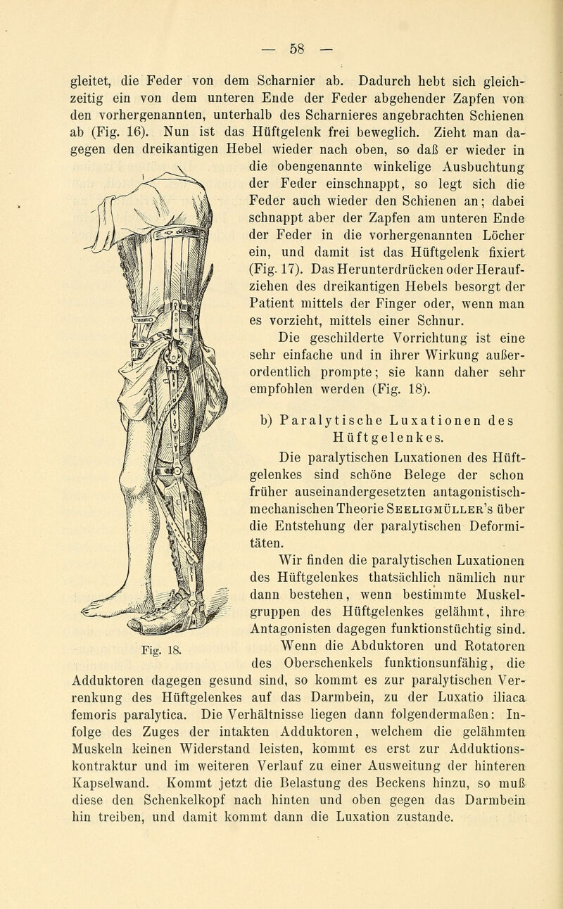 gleitet, die Feder von dem Scharnier ab. Dadurch hebt sich gleich- zeitig ein von dem unteren Ende der Feder abgehender Zapfen von den vorhergenannlen, unterhalb des Scharnieres angebrachten Schienen ab (Fig. 16). Nun ist das Hüftgelenk frei beweglich. Zieht man da- gegen den dreikantigen Hebel wieder nach oben, so daß er wieder in die obengenannte winkelige Ausbuchtung der Feder einschnappt, so legt sich die Feder auch wieder den Schienen an; dabei schnappt aber der Zapfen am unteren Ende der Feder in die vorhergenannten Löcher ein, und damit ist das Hüftgelenk fixiert (Fig. 17). Das Herunterdrücken oder Herauf- ziehen des dreikantigen Hebels besorgt der Patient mittels der Finger oder, wenn man es vorzieht, mittels einer Schnur. Die geschilderte Vorrichtung ist eine sehr einfache und in ihrer Wirkung außer- ordentlich prompte; sie kann daher sehr empfohlen werden (Fig. 18). b) Paralytische Luxationen des Hüftgelenkes. Die paralytischen Luxationen des Hüft- gelenkes sind schöne Belege der schon früher auseinandergesetzten antagonistisch- mechanischen Theorie Seeligmüller's über die Entstehung der paralytischen Deformi- täten. Wir finden die paralytischen Luxationen des Hüftgelenkes thatsächlich nämlich nur dann bestehen, wenn bestimmte Muskel- gruppen des Hüftgelenkes gelähmt, ihre Antagonisten dagegen funktionstüchtig sind. Wenn die Abduktoren und Potatoren des Oberschenkels funktionsunfähig, die Adduktoren dagegen gesund sind, so kommt es zur paralytischen Ver- renkung des Hüftgelenkes auf das Darmbein, zu der Luxatio iliaca femoris paralytica. Die Verhältnisse liegen dann folgendermaßen: In- folge des Zuges der intakten Adduktoren, welchem die gelähmten Muskeln keinen Widerstand leisten, kommt es erst zur Adduktions- kontraktur und im weiteren Verlauf zu einer Ausweitung der hinteren Kapselwand. Kommt jetzt die Belastung des Beckens hinzu, so muß diese den Schenkelkopf nach hinten und oben gegen das Darmbein hin treiben, und damit kommt dann die Luxation zustande.