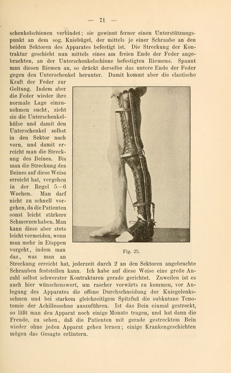 schenkelschienen verbindet; sie gewinnt ferner einen Unterstützungs- punkt an dem sog. Kniebügel, der mittels je einer Schraube an den beiden Sektoren des Apparates befestigt ist. Die Streckung der Kon- traktur geschieht nun mittels eines am freien Ende der Feder ange- brachten, an der Unterschenkelschiene befestigten Riemens. Spannt man diesen Riemen an, so drückt derselbe das untere Ende der Feder gegen den Unterschenkel herunter. Damit kommt aber die elastische Kraft der Feder zur Geltung. Indem aber die Feder wieder ihre normale Lage einzu- nehmen sucht, zieht sie die Unterschenkel- hülse und damit den Unterschenkel selbst in den Sektor nach vorn, und damit er- reicht man die Streck- ung des Beines. Bis man die Streckung des Beines auf diese Weise erreicht hat, vergehen in der Regel 5—6 Wochen. Man darf nicht zu schnell vor- gehen, da die Patienten sonst leicht stärkere Schmerzen haben. Man kann diese aber stets leicht vermeiden, wenn man mehr in Etappen vorgeht, indem man das, was man an Streckung erreicht hat, jederzeit durch 2 an den Sektoren angebrachte Schrauben feststellen kann. Ich habe auf diese Weise eine große An- zahl selbst schwerster Kontrakturen gerade gerichtet. Zuweilen ist es auch hier wünschenswert, um rascher vorwärts zu kommen, vor An- legung des Apparates die offene Durchschneidung der Kniegelenks- sehnen und bei starkem gleichzeitigem Spitzfuß die subkutane Teno- tomie der Achillessehne auszuführen. Ist das Bein einmal gestreckt, so läßt man den Apparat noch einige Monate tragen, und hat dann die Freude, zu sehen, daß die Patienten mit gerade gestrecktem Bein wieder ohne jeden Apparat gehen lernen; einige Krankengeschichten mögen das Gesagte erläutern.