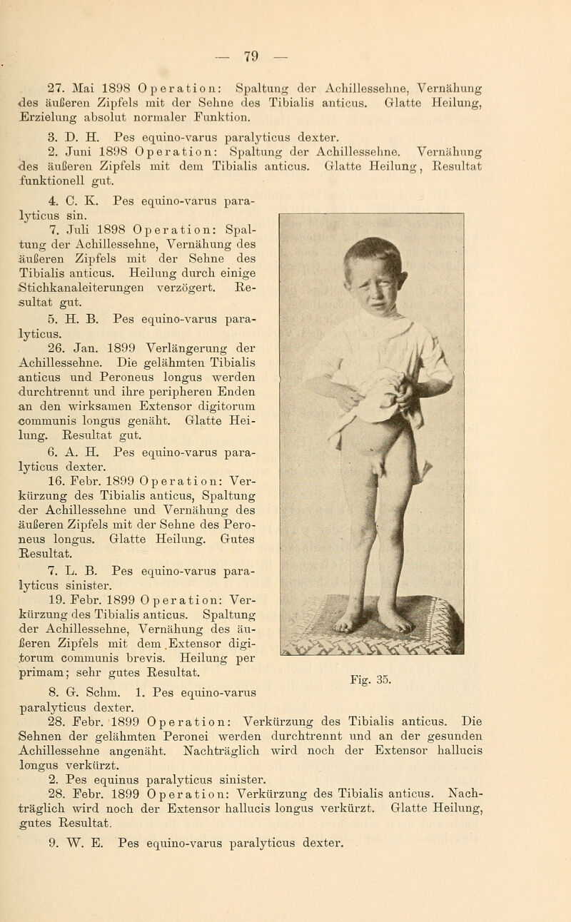 27. Mai 1898 Operation: Spaltung der Achiillesseline, Vernäliung des äußeren Zipfels mit der Sehne des Tibialis anticus. Glatte Heilung, Erzielung absolut normaler Funktion. 3. D. H. Pes equino-varus paralyticus dexter. 2. Juni 1898 Operation: Spaltung der Achillessehne. Vernähung des äußeren Zipfels mit dem Tibialis anticus. Glatte Heilung, Resultat funktionell gut. 4. C. K. Pes equino-varus para- lyticus sin, 7. Juli 1898 Operation: Spal- tung der Achillessehne, Vernähung des äußeren Zipfels mit der Sehne des Tibialis anticus. Heilung durch einige Stichkanaleiterungen verzögert. Re- sultat gut. 5. H. B. Pes equino-varus para- lyticus. 26. Jan. 1899 Verlängerung der Achillessehne. Die gelähmten Tibialis anticus und Peroneus longus werden durchtrennt und ihre peripheren Enden an den wirksamen Extensor digitorum communis longus genäht. Glatte Hei- lung. Resultat gut, 6. A. H. Pes equino-varus para- lyticus dexter. 16. Febr. 1899 Operation: Ver- kürzung des Tibialis anticus, Spaltung der Achillessehne und Vernähung des äußeren Zipfels mit der Sehne des Pero- neus longus. Glatte Heilung. Gutes Resultat. 7. L. B. Pes equino-varus para- lyticus sinister. 19. Febr. 1899 Operation: Ver- kürzung des Tibialis anticus. Spaltung der Achillessehne, Vernähung des äu- jßeren Zipfels mit dem .Extensor digi- .torum communis brevis. Heilung per primam; sehr gutes Resultat. 8. G. Schm. 1. Pes equino-varus paralyticus dexter. 28, Febr. 1899 Operation: Verkürzung des Tibialis anticus. Die Sehnen der gelähmten Peronei werden durchtrennt und an der gesunden Achillessehne angenäht. Nachträglich wird noch der Extensor hallucis longus verkürzt. 2. Pes equinus paralyticus sinister. 28. Febr. 1899 Operation: Verkürzung des Tibialis anticus. Nach- träglich wird noch der Extensor hallucis longus verkürzt. Glatte Heilung, gutes Resultat. 9. W. E. Pes equino-varus paralyticus dexter.