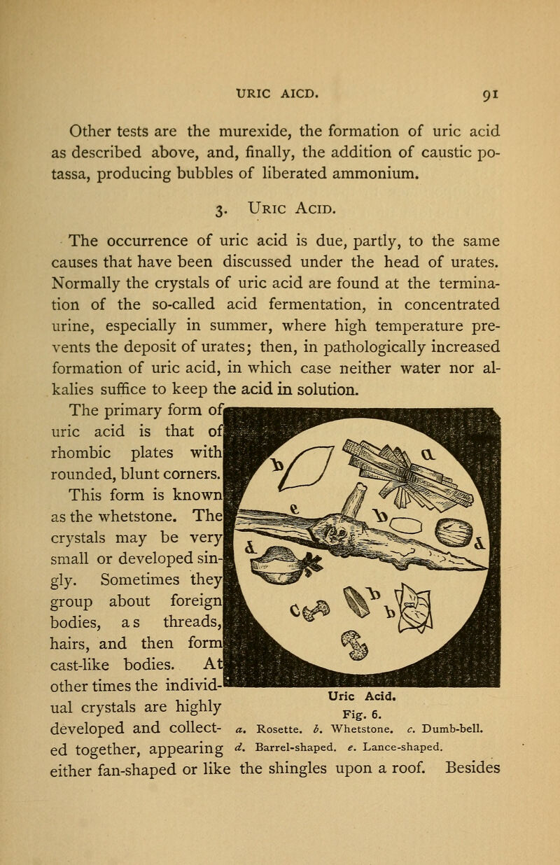 Other tests are the murexide, the formation of uric acid as described above, and, finally, the addition of caustic po- tassa, producing bubbles of liberated ammonium. 3. Uric Acid. The occurrence of uric acid is due, partly, to the same causes that have been discussed under the head of urates. Normally the crystals of uric acid are found at the termina- tion of the so-called acid fermentation, in concentrated urine, especially in summer, where high temperature pre- vents the deposit of urates; then, in pathologically increased formation of uric acid, in which case neither water nor al- kalies suffice to keep the acid in solution. The primary form of j uric acid is that o rhombic plates withi rounded, blunt corners. This form is knownl as the whetstone. The' crystals may be very| small or developed sin gly. Sometimes they group about foreign bodies, a s threads hairs, and then for: cast-like bodies. A other times the individ- ual crystals are highly developed and collect- Rosette. Uric Acid. Fig. 6. b. Whetstone. Dumb-bell. ed together, appearing d. Barrel-shaped, e. Lance-shaped. either fan-shaped or like the shingles upon a roof. Besides