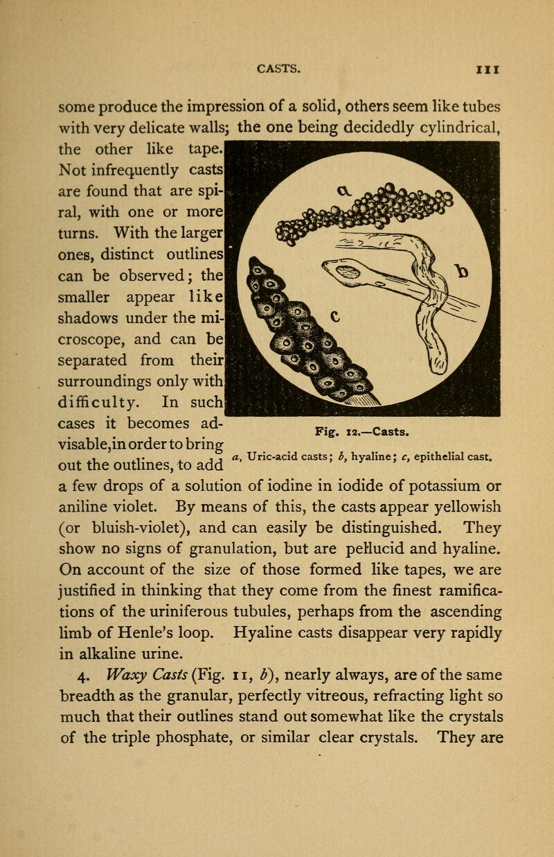 some produce the impression of a solid, others seem like tubes with very deUcate walls; the one being decidedly cylindrical, the other like tape. Not infrequently castsl are found that are spi-l ral, with one or morel turns. With the larger! ones, distinct outlinesl can be observed; the! smaller appear 1 i k el shadows under the mi-| croscope, and can be I separated from theirl surroundings only with difficulty. In such cases it becomes ad- visable,in order to bring out the outlines, to add a few drops of a solution of iodine in iodide of potassium or aniline violet. By means of this, the casts appear yellowish (or bluish-violet), and can easily be distinguished. They show no signs of granulation, but are peHucid and hyaline. On account of the size of those formed like tapes, we are justified in thinking that they come from the finest ramifica- tions of the uriniferous tubules, perhaps from the ascending limb of Henle's loop. Hyaline casts disappear very rapidly in alkaline urine. 4. Waxy Casts (Fig. 11, ^), nearly always, are of the same breadth as the granular, perfectly vitreous, refracting light so much that their outlines stand out somewhat like the crystals of the triple phosphate, or similar clear crystals. They are Fig. X2.—Casts. a. Uric-acid casts; b, hyaline; c, epithelial cast.