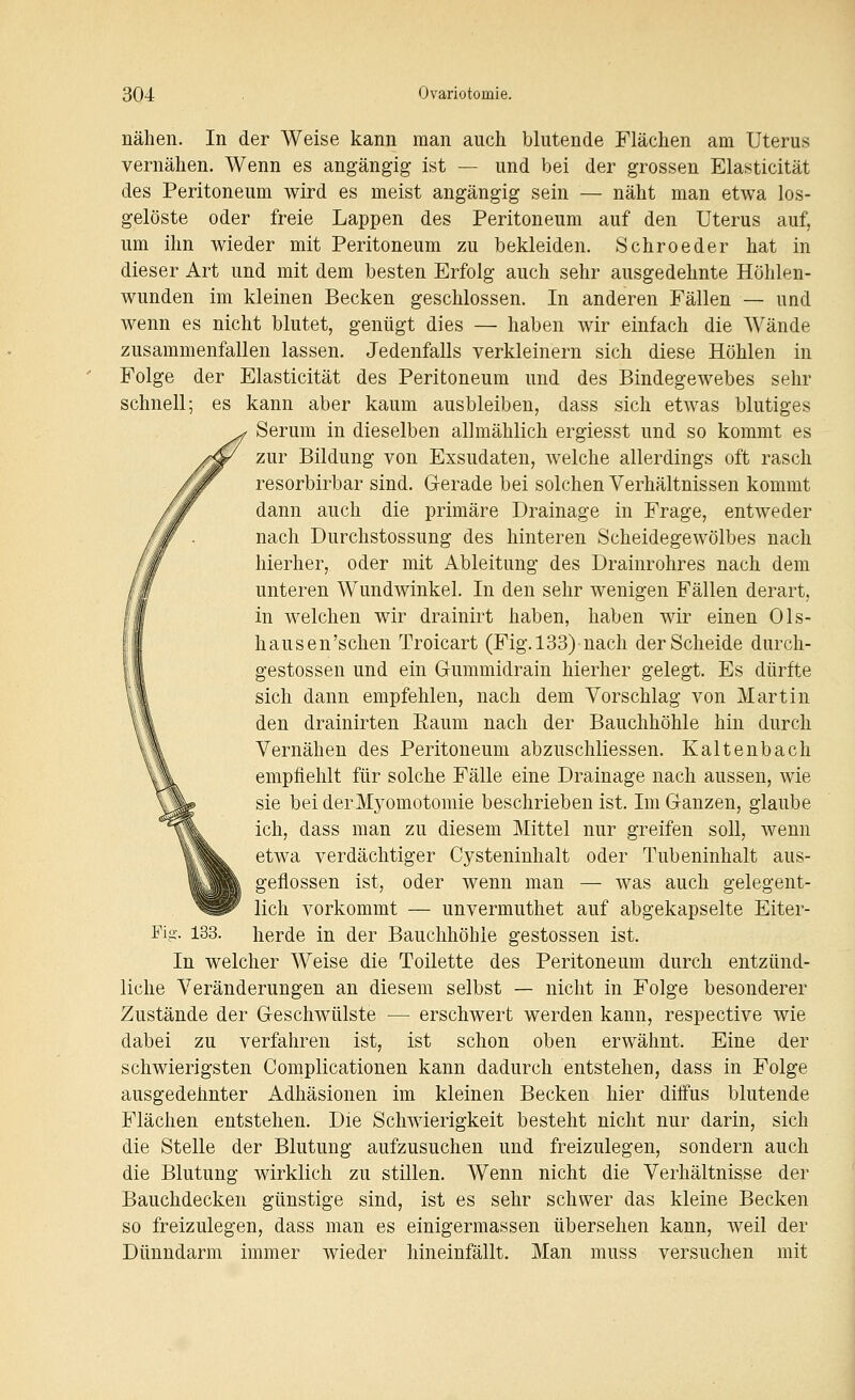 nähen. In der Weise kann man auch blutende Flächen am Uterus vernähen. Wenn es angängig ist — und bei der grossen Elasticität des Peritoneum wird es meist angängig sein — näht man etwa los- gelöste oder freie Lappen des Peritoneum auf den Uterus auf, um ihn wieder mit Peritoneum zu bekleiden. Schroeder hat in dieser Art und mit dem besten Erfolg auch sehr ausgedehnte Höhlen- wunden im kleinen Becken geschlossen. In anderen Fällen — und wenn es nicht blutet, genügt dies — haben wir einfach die Wände zusammenfallen lassen. Jedenfalls verkleinern sich diese Höhlen in Folge der Elasticität des Peritoneum und des Bindegewebes sehr schnell; es kann aber kaum ausbleiben, dass sich etwas blutiges Serum in dieselben allmählich ergiesst und so kommt es zur Bildung von Exsudaten, welche allerdings oft rasch resorbirbar sind. Gerade bei solchen Verhältnissen kommt dann auch die primäre Drainage in Frage, entweder nach Durchstossung des hinteren Scheidegewölbes nach hierher, oder mit Ableitung des Draiurohres nach dem unteren Wundwinkel. In den sehr wenigen Fällen derart, in welchen wir drainirt haben, haben wir einen 01s- hausen'schen Troicart (Fig. 133) nach der Scheide durch- gestossen und ein Gummidrain hierher gelegt. Es dürfte sich dann empfehlen, nach dem Vorschlag von Martin den drainirten Eaum nach der Bauchhöhle hin durch Vernähen des Peritoneum abzuschliessen. Kaltenbach empfiehlt für solche Fälle eine Drainage nach aussen, wie sie beiderMyomotomie beschrieben ist. Im Ganzen, glaube ich, dass man zu diesem Mittel nur greifen soll, wenn etwa verdächtiger Cysteninhalt oder Tubeninhalt aus- geflossen ist, oder wenn man — was auch gelegent- lich vorkommt — unvermuthet auf abgekapselte Eiter- herde in der Bauchhöhle gestossen ist. In welcher Weise die Toilette des Peritoneum durch entzünd- liche Veränderungen an diesem selbst — nicht in Folge besonderer Zustände der Geschwülste — erschwert werden kann, respective wie dabei zu verfahren ist, ist schon oben erwähnt. Eine der schwierigsten Complicationen kann dadurch entstehen, dass in Folge ausgedehnter Adhäsionen im kleinen Becken hier diffus blutende Flächen entstehen. Die Schwierigkeit besteht nicht nur darin, sich die Stelle der Blutung aufzusuchen und freizulegen, sondern auch die Blutung wirklich zu stillen. Wenn nicht die Verhältnisse der Bauchdecken günstige sind, ist es sehr schwer das kleine Becken so freizulegen, dass man es einigermassen übersehen kann, weil der Dünndarm immer wieder hineinfällt. Man muss versuchen mit 133.