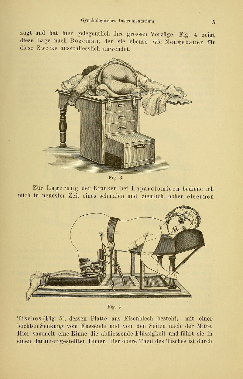 zugt und hat hier gelegentlich ihre grossen Vorzüge. Fig. 4 zeigt diese Lage nach Bozeman, der sie ebenso wie Neugebauer für diese Zwecke ausschliesslich anwendet. Fig. 3. Zur Lagerung der Kranken bei Laparotomieen bediene ich mich in neuester Zeit eines schmalen und ziemlich hohen eisernen Fig. 4. Tisches (Fig. 5), dessen Platte aus Eisenblech besteht, mit einer leichten Senkung vom Fussende und von den Seiten nach der Mitte. Hier sammelt eine Rinne die abfliessende Flüssigkeit und führt sie in einen darunter gestellten Eimer. Der obere Theil des Tisches ist durch