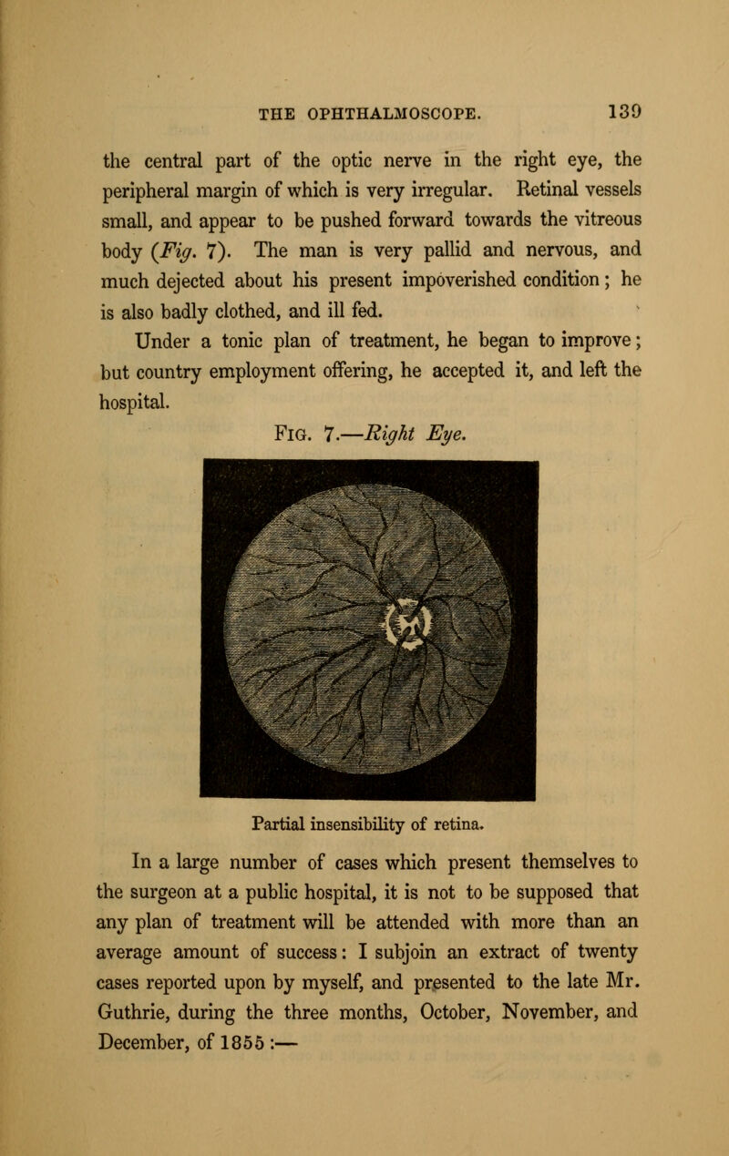 the central part of the optic nerve in the right eye, the peripheral margin of which is very irregular. Retinal vessels small, and appear to be pushed forward towards the vitreous body {Fig. 7). The man is very pallid and nervous, and much dejected about his present impoverished condition; he is also badly clothed, and ill fed. Under a tonic plan of treatment, he began to improve; but country employment offering, he accepted it, and left the hospital. Fig. 7.—Right Eye. Partial insensibility of retina. In a large number of cases which present themselves to the surgeon at a public hospital, it is not to be supposed that any plan of treatment will be attended with more than an average amount of success: I subjoin an extract of twenty cases reported upon by myself, and presented to the late Mr. Guthrie, during the three months, October, November, and December, of 1855 :—