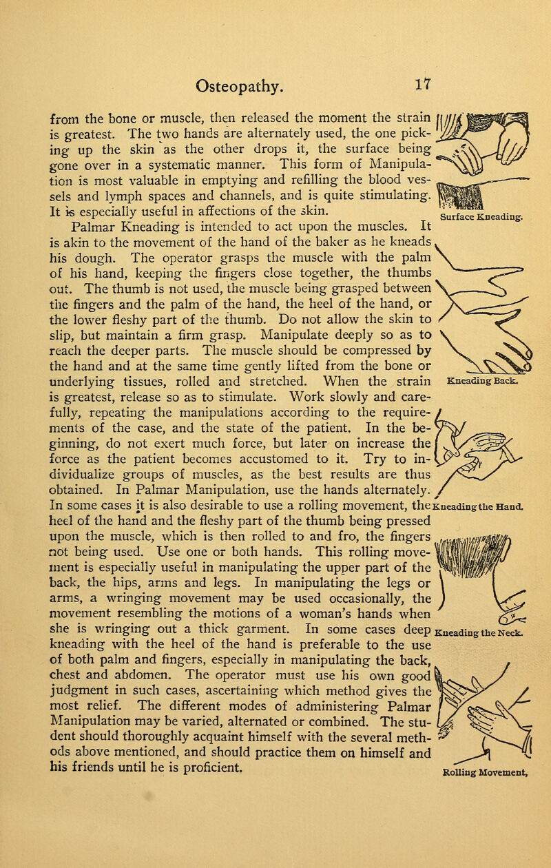 Surface Kneading. Kneading Back. from the bone or muscle, then released the moment the strain is greatest. The two hands are alternately used, the one pick- ing up the skin as the other drops it, the surface being gone over in a systematic manner. This form of Manipula- tion is most valuable in emptying and refilling the blood ves- sels and lymph spaces and channels, and is quite stimulating. It is especially useful in affections of the skin. Palmar Kneading is intended to act upon the muscles. It is akin to the movement of the hand of the baker as he kneads his dough. The operator grasps the muscle with the palm of his hand, keeping the fingers close together, the thumbs out. The thumb is not used, the muscle being grasped between the fingers and the palm of the hand, the heel of the hand, or the lower fleshy part of the thumb. Do not allow the skin to slip, but maintain a firm grasp. Manipulate deeply so as to reach the deeper parts. The muscle should be compressed by the hand and at the same time gently lifted from the bone or underlying tissues, rolled and stretched. When the strain is greatest, release so as to stimulate. Work slowly and care- fully, repeating the manipulations according to the require- ments of the case, and the state of the patient. In the be-' ginning, do not exert much force, but later on increase the force as the patient becomes accustomed to it. Try to in- dividualize groups of muscles, as the best results are thus obtained. In Palmar Manipulation, use the hands alternately. In some cases it is also desirable to use a rolling movement, the Kneading the Hand, heel of the hand and the fleshy part of the thumb being pressed upon the muscle, v/hich is then rolled to and fro, the fingers not being used. Use one or both hands. This rolling move- ment is especially useful in manipulating the upper part of the back, the hips, arms and legs. In manipulating the legs or arms, a wringing movement may be used occasionally, the movement resembling the motions of a woman's hands when she is wringing out a thick garment. In some cases deep Kneading the Neck, kneading with the heel of the hand is preferable to the use of both palm and fingers, especially in manipulating the back, chest and abdomen. The operator must use his own good judgment in such cases, ascertaining which method gives the most relief. The different modes of administering Palmar Manipulation may be varied, alternated or combined. The stu- dent should thoroughly acquaint himself with the several meth- ^ ods above mentioned, and should practice them on himself and his friends until he is proficient. Rouing Movement.