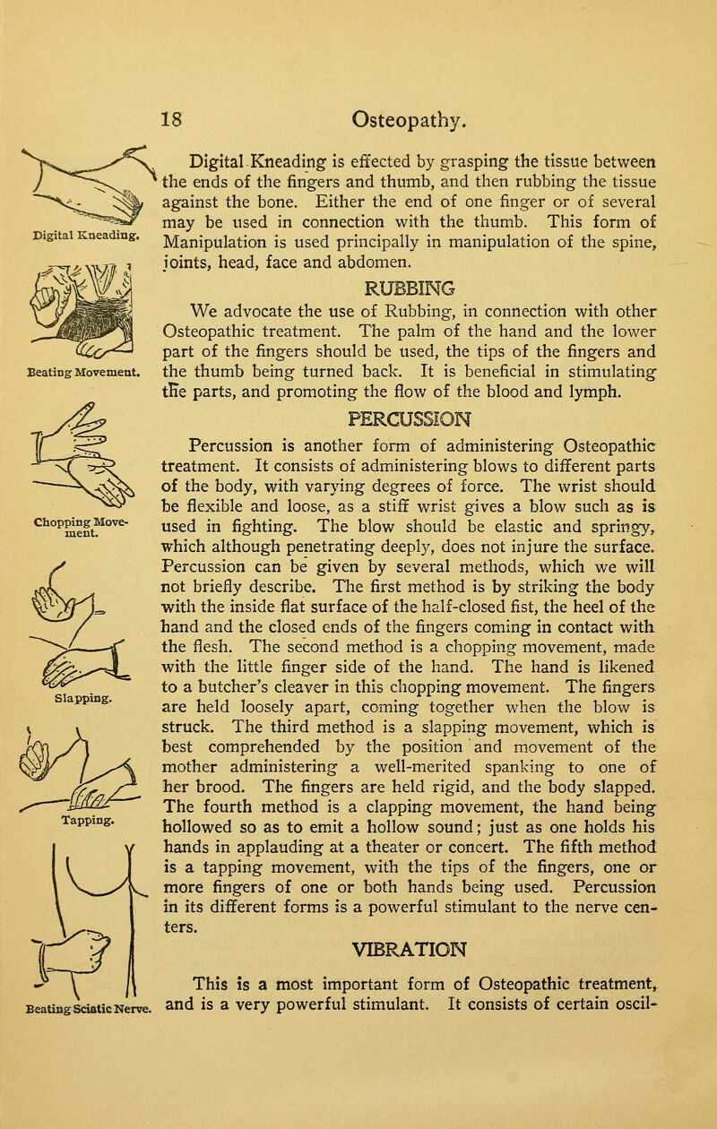 Digital Kneading. Digital Kneading is effected by grasping the tissue between the ends of the fingers and thumb, and then rubbing the tissue against the bone. Either the end of one finger or of several may be used in connection with the thumb. This form of Manipulation is used principally in manipulation of the spine, joints, head, face and abdomen. RUBBING We advocate the use of Rubbing, in connection with other Osteopathic treatment. The palm of the hand and the lower part of the fingers should be used, the tips of the fingers and the thumb being turned back. It is beneficial in stimulating tHe parts, and promoting the flow of the blood and lymph. Chopping Move- ment. Slapping. Beating Movement. Percussion is another form of administering Osteopathic treatment. It consists of administering blows to different parts of the body, with varying degrees of force. The wrist should be flexible and loose, as a stiff wrist gives a blow such as is used in fighting. The blow should be elastic and springy, which although penetrating deeply, does not injure the surface. Percussion can be given by several methods, which we will not briefly describe. The first method is by striking the body with the inside flat surface of the half-closed fist, the heel of the hand and the closed ends of the fingers coming in contact with the flesh. The second method is a chopping movement, made with the little finger side of the hand. The hand is likened to a butcher's cleaver in this chopping movement. The fingers are held loosely apart, coming together when the blow is struck. The third method is a slapping movement, which is best comprehended by the position and movement of the mother administering a well-merited spanking to one of her brood. The fingers are held rigid, and the body slapped. The fourth method is a clapping movement, the hand being hollowed so as to emit a hollow sound; just as one holds his hands in applauding at a theater or concert. The fifth method is a tapping movement, with the tips of the fingers, one or more fingers of one or both hands being used. Percussion in its different forms is a powerful stimulant to the nerve cen- ters. VIBRATION j^ This is a most important form of Osteopathic treatment, Beating Sciatic Nerve, ^nd is a very powcrful Stimulant. It consists of certain oscil-