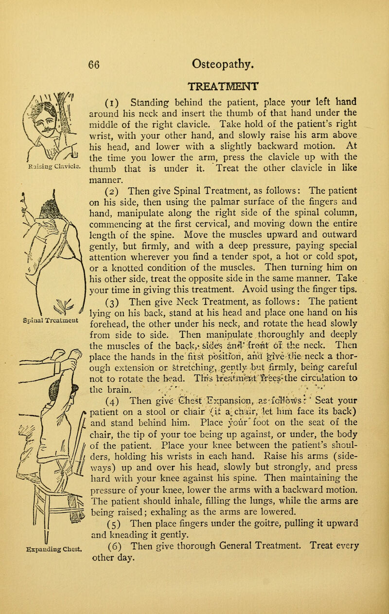 Raising Clavicls TREATMENT (i) Standing behind the patient, place youf left hand around his neck and insert the thumb of that hand under the middle of the right clavicle. Take hold of the patient's right wrist, v/ith your other hand, and slowly raise his arm above his head, and lower with a slightly backward motion. At the time you lower the arm, press the clavicle up with the thumb that is under it. Treat the other clavicle in like manner. (2) Then give Spinal Treatment, as follows: The patient on his side, then using the palmar surface of the fingers and hand, manipulate along the right side of the spinal column, commencing at the first cervical, and moving down the entire length of the spine. Move the muscles upward and outward gently, but firmly, and with a deep pressure, paying special attention wherever you find a tender spot, a hot or cold spot, or a knotted condition of the muscles. Then turning him on his other side, treat the opposite side in the same manner. Take your time in giving this treatment. Avoid using the finger tips. (3) Then give Neck Treatment, as follows: The patient lying on his back, stand at his head and place one hand on his forehead, the other under his neck, and rotate the head slowly from side to side. Then manipulate thoroughly and deeply the muscles of the bapk,', side^ 4n3' 'front 6f: the neck. Then ^_^^;^^^>0 place the hands in thefiirst position, and ^ive-'the neck a thor- ^ ough extension or fetretchingj,gently rbut firmly, being careful not to rotate the head. This 't3^efilmetit;'$rees-the circulation to the brain. '/';, ■-, ' ', '' (4) Then give (Shest Expansion^ as-icrl']6Wsr' Seat your patient on a stool or chaii^ /i,i aichiir, let him face its back) and stand behind him. Place your'foot on the seat of the chair, the tip of your toe being up against, or under, the body of the patient. Place your knee between the patient's shoul- Ijl ders, holding his wrists in each hand. Raise his arras (side- v/ays) up and over his head, slowly but strongly, and press hard with your knee against his spine. Then maintaining the pressure of your knee, lower the arms with a backward motion. The patient should inhale, filling the lungs, while the arms are being raised; exhaling as the arms are lowered. (5) Then place fingers under the goitre, pulling it upward and kneading it gently. (6) Then give thorough General Treatment. Treat every other day. Spinal Treatment «^: Sspauding Chest.