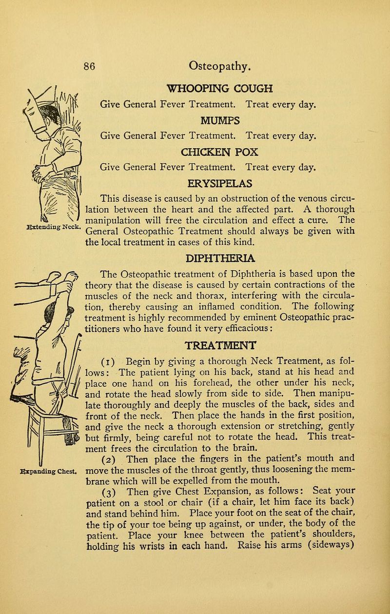 WHOOPING COUGH Give General Fever Treatment. Treat every day. MUMPS Give General Fever Treatment. Treat every day. CHICKEN POX Give General Fever Treatment. Treat every day. ERYSIPELAS This disease is caused by an obstruction of the venous circu- lation between the heart and the affected part. A thorough manipulation will free the circulation and effect a cure. The Exten jng ec . Qq^^j.^^ Osteopathic Treatment should always be given with the local treatment in cases of this kind. DIPHTHEPtlA The Osteopathic treatment of Diphtheria is based upon the theory that the disease is caused by certain contractions of the muscles of the neck and thorax, interfering with the circula- tion, thereby causing an inflamed condition. The following treatment is highly recommended by eminent Osteopathic prac- titioners who have found it very efficacious: TREATMENT (1) Begin by giving a thorough Neck Treatment, as fol- lows: The patient lying on his back, stand at his head and place one hand on his forehead, the other under his neck, and rotate the head slowly from side to side. Then manipu- late thoroughly and deeply the muscles of the back, sides and front of the neck. Then place the hands in the first position, and give the neck a thorough extension or stretching, gently but firmly, being careful not to rotate the head. This treat- ment frees the circulation to the brain. (2) Then place the fingers in the patient's mouth and move the muscles of the throat gently, thus loosening the mem- brane which will be expelled from the mouth. (3) Then give Chest Expansion, as follows: Seat your patient on a stool or chair (if a chair, let him face its back) and stand behind him. Place your foot on the seat of the chair, the tip of your toe being up against, or under, the body of the patient. Place your knee between the patient's shoulders, holding his wrists in each hand. Raise his arms (sideways) Szpanding Chest.