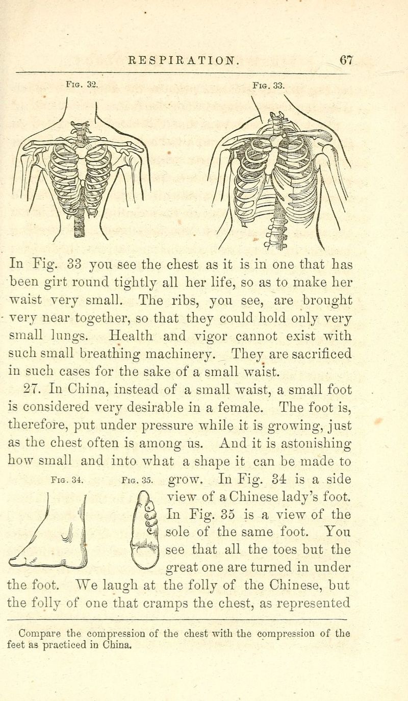 Fig. 32. Fig. 33. In Fig. 33 you see the chest as it is in one that has been girt round tightly all her life, so as to make her waist very small. The ribs, you see, are brought very near together, so that they could hold only very small lungs. Health and vigor cannot exist with such small breathing machinery. They are sacrificed in such cases for the sake of a small waist. 27. In China, instead of a small waist, a small foot is considered very desirable in a female. The foot is, therefore, put under pressure while it is growing, just as the chest often is among us. And it is astonishing how small and into what a shape it can be made to fig. 34. Fig. 35. grow. In Fig. 34: is a side view of a Chinese lady's foot. In Fig. 35 is a view of the sole of the same foot. You see that all the toes but the great one are turned in under the foot. We laugh at the folly of the Chinese, but the folly of one that cramps the chest, as represented Compare the compression of the chest with the compression of the feet a3 practiced in China,