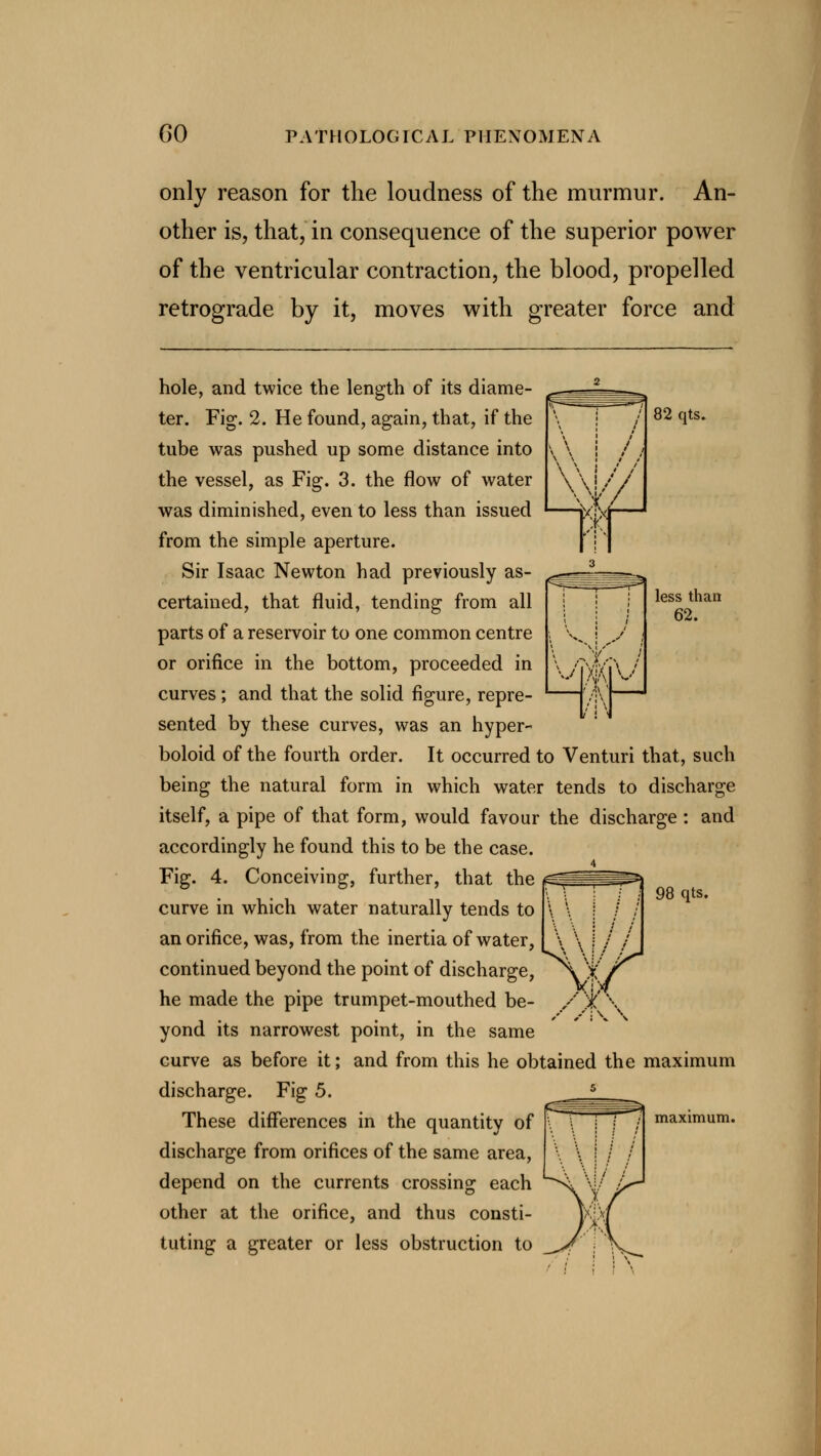 only reason for the loudness of the murmur. An- other is, that, in consequence of the superior power of the ventricular contraction, the blood, propelled retrograde by it, moves with greater force and 82 qts. less than 62. hole, and twice the length of its diame- ter. Fig. 2. He found, again, that, if the tube was pushed up some distance into the vessel, as Fig. 3. the flow of water was diminished, even to less than issued from the simple aperture. Sir Isaac Newton had previously as- certained, that fluid, tending from all parts of a reservoir to one common centre or orifice in the bottom, proceeded in curves ; and that the solid figure, repre- sented by these curves, was an hyper- boloid of the fourth order. It occurred to Venturi that, such being the natural form in which water tends to discharge itself, a pipe of that form, would favour the discharge : and accordingly he found this to be the case. Fig. 4. Conceiving, further, that the curve in which water naturally tends to an orifice, was, from the inertia of water, continued beyond the point of discharge, he made the pipe trumpet-mouthed be- yond its narrowest point, in the same curve as before it; and from this he obtained the maximum discharge. Fig 5. These differences in the quantity of discharge from orifices of the same area, depend on the currents crossing each other at the orifice, and thus consti- tuting a greater or less obstruction to 98 qts.