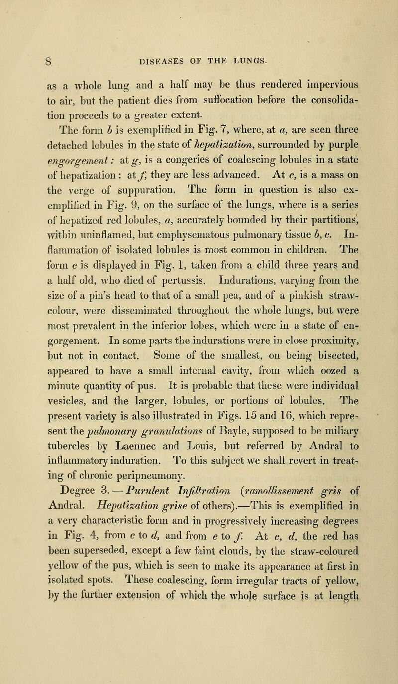 as a whole lung and a half may be thus rendered impervious to air, but the patient dies from suffocation before the consolida- tion proceeds to a greater extent. The form h is exemplified in Fig. 7, where, at a, are seen three detached lol)ules in the state of hepatization, surrounded by purple. engorgement: at g, is a congeries of coalescing lobules in a state of hepatization : at/, they are less advanced. At c, is a mass on the verge of suppuration. The form in question is also ex- emplified in Fig. 9, on the surface of the lungs, where is a series of hepatized red lobules, a, accurately bounded by their partitions, within uninflamed, but emphysematous puhnonary tissue h, c. In- flammation of isolated lobules is most common in children. The form c is displayed in Fig. 1, taken from a child three years and a half old, who died of pertussis. Indurations, varying from the size of a pin's head to that of a small pea, and of a pinkish straw- colour, were disseminated throughout the whole lungs, but were most prevalent in the inferior lobes, which were in a state of en^ gorgement. In some parts the indurations were in close proximity, but not in contact. Some of the smallest, on being bisected, appeared to have a small internal cavity, from which oozed a minute quantity of pus. It is probable that these were individual vesicles, and the larger, lobules, or portions of lobules. The present variety is also illustrated in Figs. 15 and 16, which repre^ sent the pulmonary granulations of Bayle, supposed to be miliary tubercles by Laennec and Louis, but referred by Andral to inflammatory induration. To this subject we shall revert in treats ing of chronic peripneumony. Degree 3. — Purulent Infiltration {ramoUissement gris of Andral. Hepatization grise oi oi\\ei'&),—This is exemplified in a very characteristic form and in progressively increasing degrees in Fig. 4, from c to d, and from e to f. At c, d, the red has been superseded, except a few faint clouds, by the straw-coloured yellow of the pus, which is seen to make its appearance at first in isolated spots. These coalescing, form irregular tracts of yellow, by the further extension of which the whole surface is at length