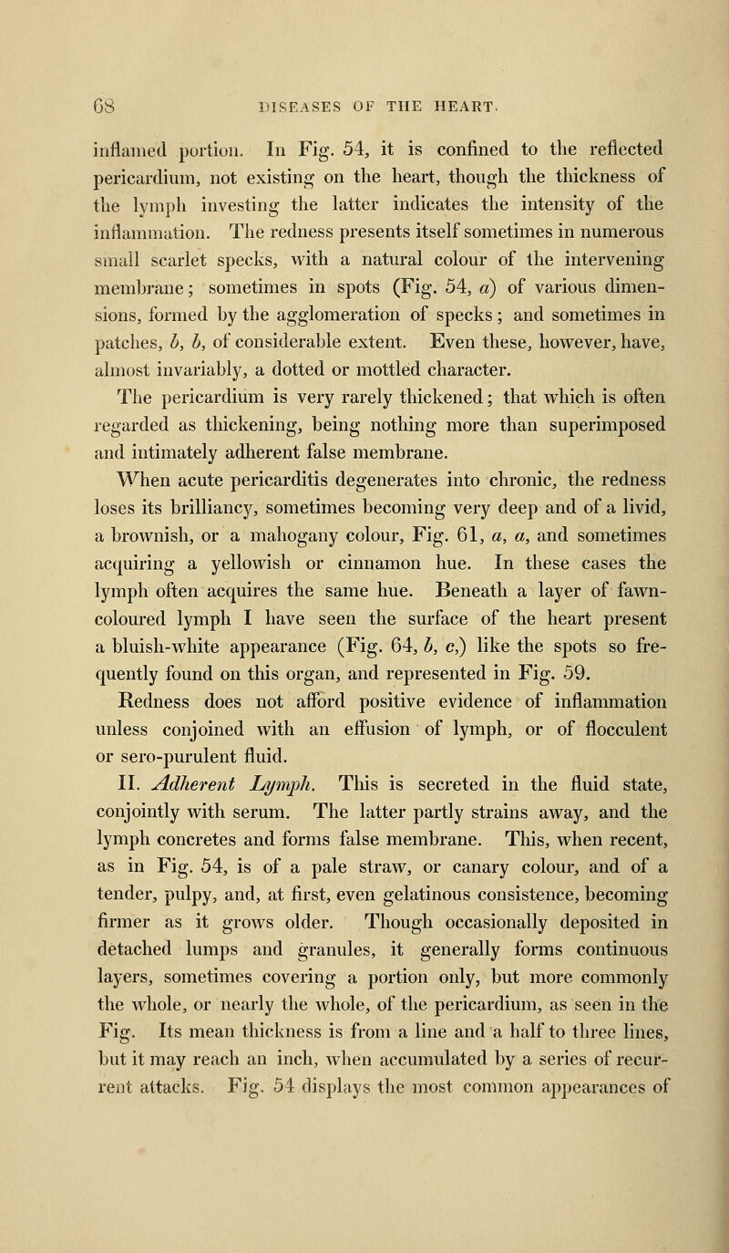 iiiflamed portion. In Fig. 54, it is confined to the reflected pericardium, not existing on the heart, though the thickness of the lymph investing the latter indicates the intensity of the inflammation. The redness presents itself sometimes in numerous small scarlet specks, with a natural colour of the intervening membrane; sometimes in spots (Fig. 54, a) of various dimen- sions, formed by the agglomeration of specks; and sometimes in patches, b, h, of considerable extent. Even these, however, have, almost invariably, a dotted or mottled character. The pericardium is very rarely thickened; that wdiicli is often regarded as thickening, being nothing more than superimposed and intimately adherent false membrane. When acute pericarditis degenerates into chronic, the redness loses its brilliancy, sometimes becoming very deep and of a livid, a brownish, or a mahogany colour. Fig. 61, a, a, and sometimes acquiring a yellowish or cinnamon hue. In these cases the lymph often acquires the same hue. Beneath a layer of fawn- coloured lymph I have seen the surface of the heart present a bluish-white appearance (Fig. 64, h, c,) like the spots so fre- quently found on this organ, and represented in Fig. 59. Redness does not afford positive evidence of inflammation unless conjoined with an effusion of lymph, or of flocculent or sero-purulent fluid. II. Adherent Lymph. This is secreted in the fluid state, conjointly with serum. The latter partly strains away, and the lymph concretes and forms false membrane. This, when recent, as in Fig. 54, is of a pale straw, or canary colour, and of a tender, pulpy, and, at first, even gelatinous consistence, becoming firmer as it grows older. Though occasionally deposited in detached lumps and granules, it generally forms continuous layers, sometimes covering a portion only, but more commonly the whole, or nearly the whole, of the pericardium, as seen in the Fig. Its mean thickness is from a line and a half to three lines, but it may reach an inch, when accumulated by a series of recur- rent attacks. Fig. 54 displays the most common appearances of