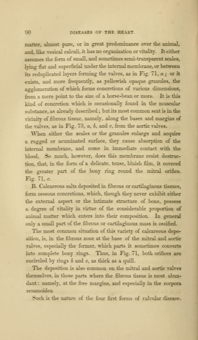 matter, afanost pure, or in great pKsdaannaiice oiter the animate and,Kke YeacalcakiiliithasDOogganiicatMwacg-YitaKty. It either asBmnes die fixm cf smaD, and someAimes aani-tran^pasait arak«, lying flat and so^erfidaliinder the intenialniaDDlKane, or between its icdo^licated layers fonning die Tabres, as in Fig.' 71, a ; or it exists, and more freqnenti^,. as yeUoiri^ c^paque granules, die asi^onierationi of widdi fixms ouuciefjons of Tanoas dimesEaoras, from a mere point to die sbe of a hor^-bean or moie. It is tliis kind of concretifu ivliich. is ocrasionally found in tlie mnscular substance,as alreai^ described; butitsmostcogDamonseatisindie Tidnity of fibrous tissue, namely, akng die bases »id marg^ of tbe Talres, as in Fig. 73, a, b, and e, &aai tbe aortic Tatres. When ddier tbe scales or tbe grannle« cfdarge and acquire a rugged or acuminated snr&ce, tl^v : sorption of tbe mtpmal membrane, and come in ir:~ :>ntact widi the biood. So mndi, bonrerer, doe> :_:; ^ist destruc- tim, diat, in tbe form of a ddica:T :_; „ z i^ T^T—ered the greater part of the bcmy r:_^ :;-i-i :^- :_ . lice. Fig. 71, e. B. Calcareous salts deposited in fibrous or cartilagiaons tissues, fiorm o^ecNis cmicretioiis, which, diough diey neTer eshilMt eidier die estran^ aspect or die intimate structure of bonc^ possess a degree of vitality in virtoe of tbe considerable proportian of anrniail matter which enters into dieir compoatian. In general only a snaQ part of the fibrous or cartilaginous mass is ssifi**! TIt : : common situatini of this Tanelj of calcareous depo- sid*:n, is, ::. :: r librons zone at die base of the mitral and aortic Talves, e? 7 ^-? fixmer, which parts it sranetimes conTcrts into COIL _7 rings. Thus, in Fi^. 71. b«jd» orifices are encircled _5 b and c, as diic:i: 2.5 i lill. TIt n is also eommoi. _ :. r : . and aortic Talres tl :_ - :*s wiiere : z - is most abun- dant: L-aiiieiy, i: '.-T ::t- ■-7_:':\- ^.. :- r_:^/ :.. '^ corpora sesamwde-. Such i: :.„ -.;: i.rms of Talrular disease.