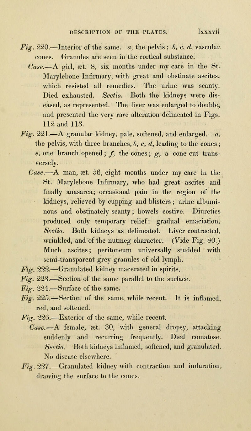 Fig. 2'20.—Interior of the same, a, the pelvis ; b, c, d, vascuhir cones. Gnmules are seen in the cortical substance. Case.—A girl, cet. 8, six months under my care in the St. JMarylebone Intirmary, with great and obstinate ascites, which resisted all remedies. The urine was scanty. Died exhausted. Sectio. Both the kidneys were dis- eased, as represented. The liver was enlarged to double, and presented the very rare alteration delineated in Figs. 112 and 113. Fig. 221.—A granular kidney, pale, softened, and enlarged, a, the pelvis, with three branches, b, c, d, leading to the cones; e, one branch opened; f, the cones; g, a cone cut trans- versely. Case.—A man, set. 56, eight months under my care in the St. Marylebone Infirmary, who had great ascites and finally anasarca; occasional pain in the region of the kidneys, relieved by cupping and blisters ; urine albumi- nous and obstinately scanty; bowels costive. Diuretics produced only temporary relief: gradual emaciation. Sectio. Both kidneys as delineated. Liver contracted, wrinkled, and of the nutmeg character. (Vide Fig. 80.) Much ascites; peritoneum universally studded with semi-transparent grey granules of old lymph. Fig. 222.—Granulated kidney macerated in spirits. Fig. 223.—Section of the same parallel to the surface. Fig. 224.—Surface of the same. Fig. 225.—Section of the same, while recent. It is inflamed, red, and softened. Fig. 226.—Exterior of the same, Avhile recent. Case.—A female, eet. 30, with general dropsy, attacking suddenly and recurring frequently. Died comatose. Sectio. Both kidneys inflamed, softened, and granulated. No disease elsewhere. Fig. 227.—Granulated kidney with contraction and induration^ drawing the surface to the cones.