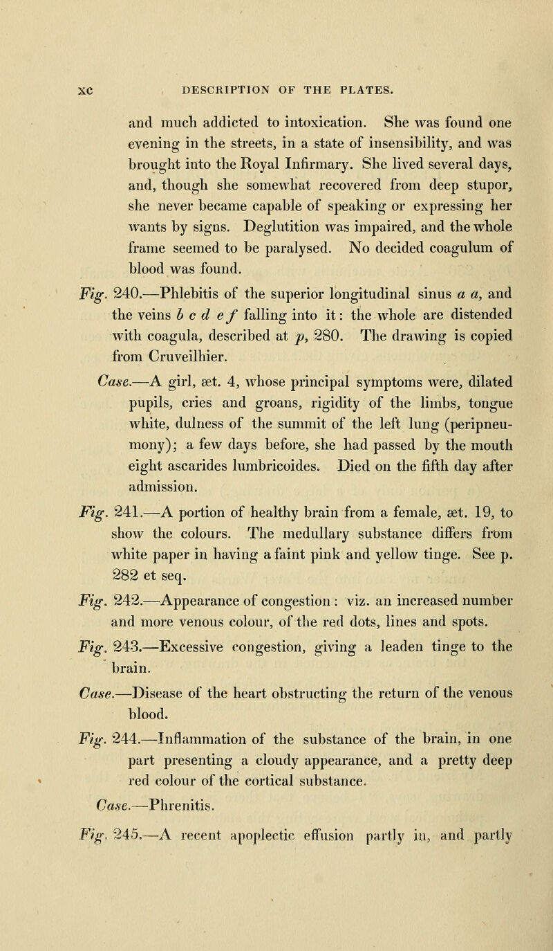 and much addicted to intoxication. She was found one evening in the streets, in a state of insensibility, and was brought into the Royal Infirmaiy. She lived several days, and, though she somewhat recovered from deep stupor, she never became capable of speaking or expressing her wants by signs. Deglutition was impaired, and the whole frame seemed to be paralysed. No decided coagulum of blood was found. Fig. 240.—Phlebitis of the superior longitudinal sinus a a, and the veins h c d ef falling into it: the whole are distended with coagula, described at -p, 280. The drawing is copied from Cruveilhier. Case.—A girl, set. 4, whose principal symptoms were, dilated pupils, cries and groans, rigidity of the limbs, tongue white, dulness of the summit of the left lung (peripneu- mony); a few days before, she had passed by the mouth eight ascarides lumbricoides. Died on the fifth day after admission. Fig. 241.—A portion of healthy brain from a female, set. 19, to show the colours. The medullary substance differs from white paper in having a faint pink and yellow tinge. See p. 282 et seq. Fig. 242.—Appearance of congestion : viz. an increased number and more venous colour, of the red dots, lines and spots. Fig. 243.—Excessive congestion, giving a leaden tinge to the brain. Case.—Disease of the heart obstructing the return of the venous blood. Fig. 244.—Inflammation of the substance of the brain, in one part presenting a cloudy appearance, and a pretty deep red colour of the cortical substance. Case.—Phrenitis. Fig. 245.—A recent apoplectic effusion partly ia, and partly