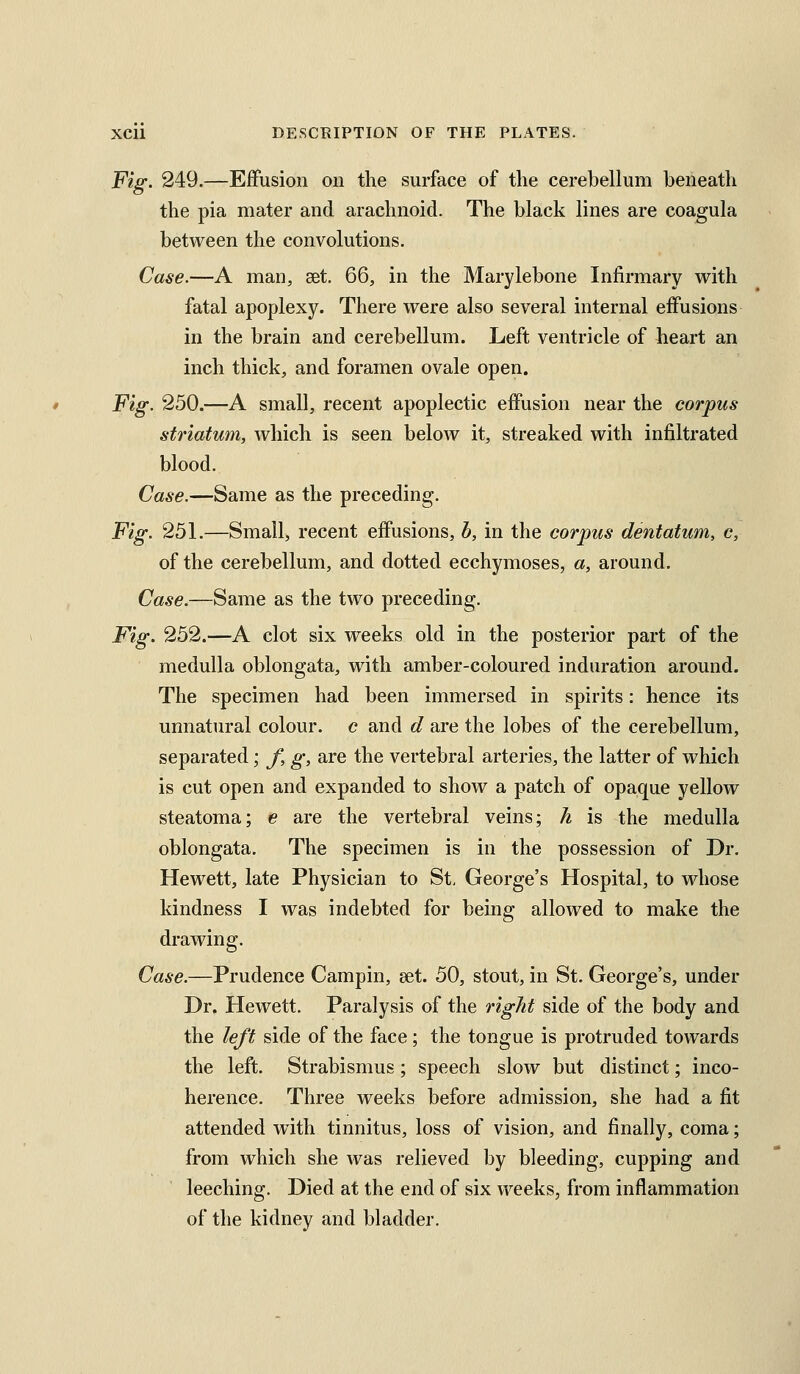 XCll DESCRIPTION OF THE PLATES. Fig. 249.—Effusion on the surface of the cerebellum beneath the pia mater and arachnoid. The black lines are coa^ula between the convolutions. Case.—A man, set. 66, in the Marylebone Infirmary with fatal apoplexy. There were also several internal effusions in the brain and cerebellum. Left ventricle of heart an inch thick, and foramen ovale open. Fig. 250.—A small, recent apoplectic effusion near the corpus striatum, which is seen below it, streaked with infiltrated blood. Case.—Same as the preceding. Fig. 251.—Small, recent effusions, h, in the corpus dentatum, c, of the cerebellum, and dotted ecchymoses, a, around. Case.—Same as the two preceding. Fig. 252.—A clot six weeks old in the posterior part of the medulla oblongata, with amber-coloured induration around. The specimen had been immersed in spirits: hence its unnatural colour, c and d are the lobes of the cerebellum, separated; f, g, are the vertebral arteries, the latter of which is cut open and expanded to show a patch of opaque yellow steatoma; e are the vertebral veins; h is the medulla oblongata. The specimen is in the possession of Dr. Hewett, late Physician to St, George's Hospital, to whose kindness I was indebted for bemg allowed to make the drawing. Case.—Prudence Campin, set. 50, stout, in St. George's, under Dr. Hewett. Paralysis of the right side of the body and the left side of the face; the tongue is protruded towards the left. Strabismus; speech slow but distinct; inco- herence. Three weeks before admission, she had a fit attended with tinnitus, loss of vision, and finally, coma; from which she was relieved by bleeding, cupping and leeching. Died at the end of six weeks, from inflammation of the kidney and bladder.