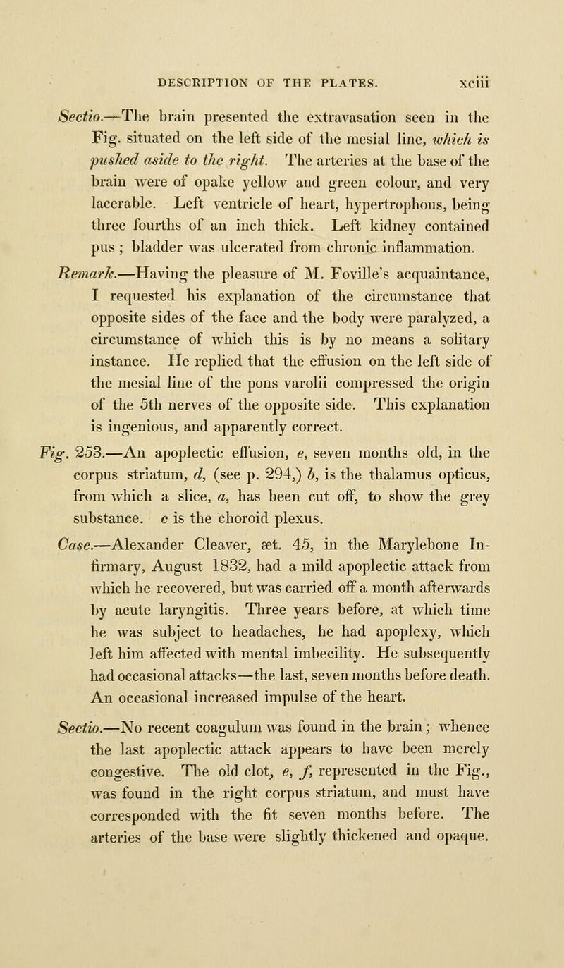 Sectio.-—The brain presented the extravasation seen in the Fig. situated on the left side of the mesial line, which is pushed aside to the right. The arteries at the base of the brain were of opake yellow and green colour, and very lacerable. Left ventricle of heart, hypertrophous, being- three fourths of an inch thick. Left kidney contained pus ; bladder was ulcerated from chronic inflammation. Remark.—Having the pleasure of M. Foville's acquaintance, I requested his explanation of the circumstance that opposite sides of the face and the body were paralyzed, a circumstance of which this is by no means a solitary instance. He replied that the effusion on the left side of the mesial line of the pons varolii compressed the origin of the 5th nerves of the opposite side. This explanation is ingenious, and apparently correct. Fig. 253.—An apoplectic effusion, e, seven months old, in the corpus striatum, d, (see p. 294,) b, is the thalamus opticus, from which a slice, a, has been cut off, to show the grey substance, c is the choroid plexus. Case.—Alexander Cleaver, set. 45, in the Marylebone In- firmary, August 1832, had a mild apoplectic attack from which he recovered, but was carried off a month afterwards by acute laryngitis. Three years before, at which time he was subject to headaches, he had apoplexy, which left him affected with mental imbecility. He subsequently had occasional attacks—the last, seven months before death. An occasional increased impulse of the heart. Sectio.—No recent coagulum was found in the brain; whence the last apoplectic attack appears to have been merely congestive. The old clot_, e, f, represented in the Fig., was found in the right corpus striatum, and must have corresponded with the fit seven months before. The arteries of the base were slightly thickened and opaque.