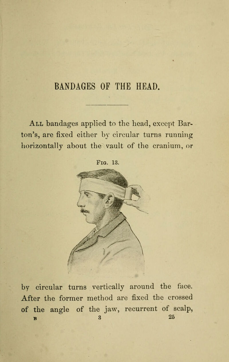 BANDAGES OF THE HEAD. All bandages applied to the head, except Bar- ton's, are fixed either by circular turns running horizontally about the vault of the cranium, or Fig. 13. - by circular turns vertically around the face. After the former method are fixed the crossed of the angle of the jaw, recurrent of scalp,