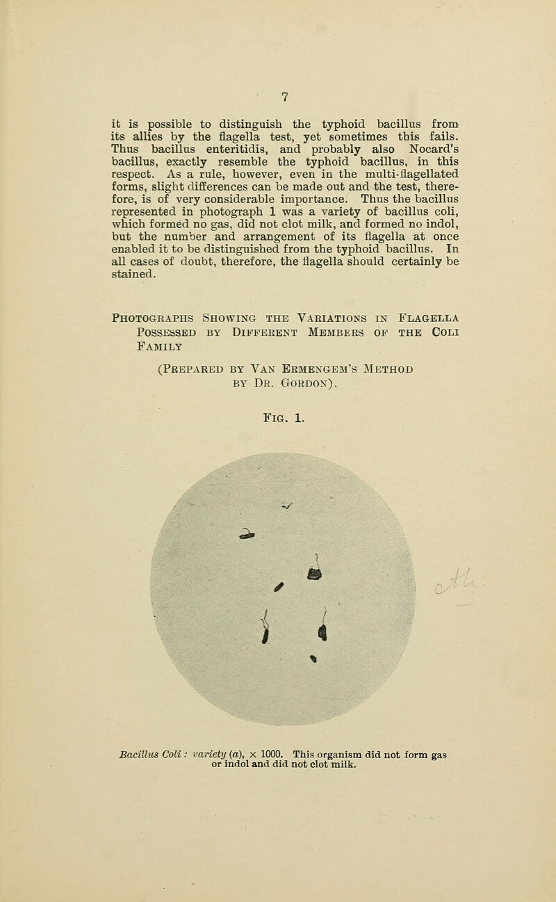 it is possible to distinguish the typhoid bacillus from its allies by the flagella test, yet sometimes this fails. Thus bacillus enteritidis, and probably also Nocard's bacillus, exactly resemble the typhoid bacillus, in this respect. As a rule, however, even in the multi-flagellated forms, slight differences can be made out and the test, there- fore, is of very considerable importance. Thus the bacillus represented in photograph 1 v?as a variety of bacillus coli, which formed no gas, did not clot milk, and formed no indol, but the number and arrangement of its flagella at once enabled it to be distinguished from the typhoid bacillus. In all cases of doubt, therefore, the flagella should certainly be stained. Photographs Showing the Vaeiations in Flagella Possessed by Diffeeent Members of the Coli Family (Prepared by Van Eemengem's Method BY Dr. Gordon). Fig. 1. Bacillus Coli : vanety (a), x 1000. This organism did not form or indol and did not clot milk.
