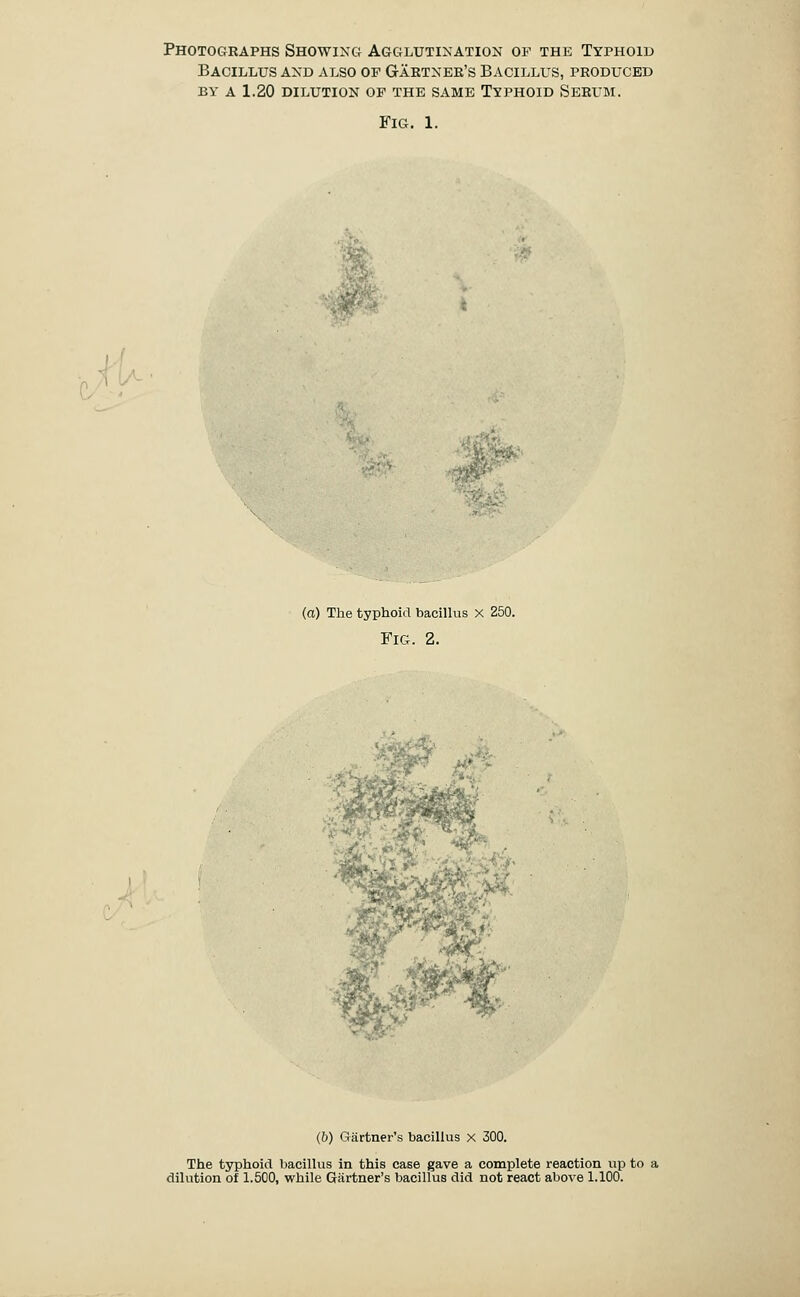 Photographs Showing Agglutination op the Typhoid Bacillus and also of G-aetnee's Bacillus, produced BY A 1.20 dilution op the same Typhoid Serum. Fig. 1. (a) The typhoid bacillus x 250. Fig. 2. '^1^ ^4' (&) Gartner's bacillus x 300. The typhoid bacillus in this case gave a complete reaction up to dilution of 1.500, while Gartner's bacillus did not react above 1.100.