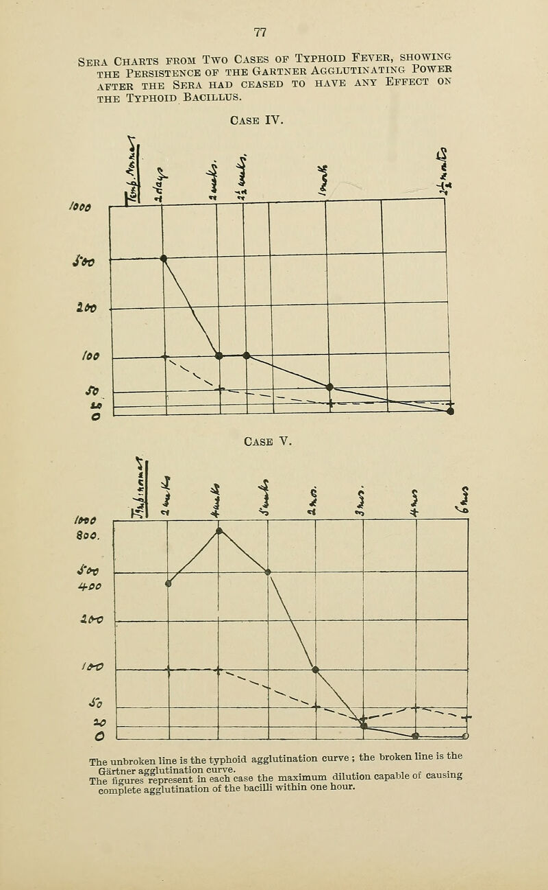 Ser\ Charts from Two Cases of Typhoid Fever, showing THE Persistence of the Gartner Agglutinating Power AFTER the Sera had ceased to have ant Effect on THE Typhoid Bacillus. Case IV. looe S'&o loo Si} to O 1 k 1 4 3 ■s -<* I 1 1 i ^•* i ^ --^^ >,.^_  ■ - --•■ h—^^^^ ^^ --^X Case V. /»90 9oo, XM} />t? Vo / \ , { ^ ^^^ ^^-^ \ - .  ~~^\^^ ^, -- ^ - \ '■—1> JTo C The unbroken line is the typhoid agglutination curve ; the broken line is the Th?£res^rfS^ent°LTa7hcase the maximum dilution capable of causing complete agglutination of the bacilli within one hour.