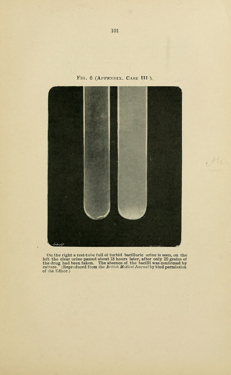 Fig. 6 (Appendix. Case TTT ). On the right a test-tube full of turbid bacilluric urine is seen, on the left the clear urine passed about 18 hours later, after only 20 grains of the drug had been taken. The absence of the bacilli was confirmed by cul ture. (Reproduced from the British Medical Journal by kind permission