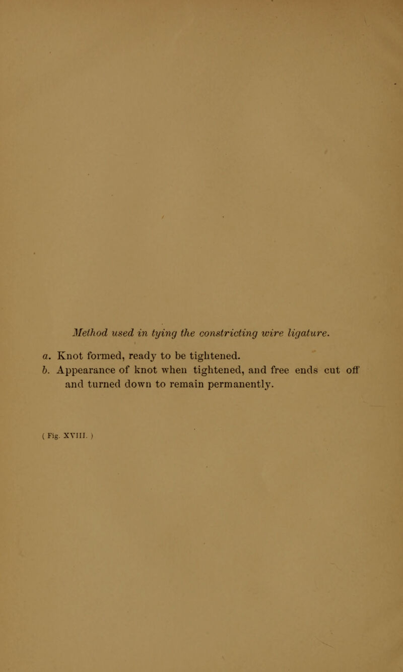 Method used in tying the constricting wire ligature. a. Knot formed, ready to be tightened. b. Appearance of knot when tightened, and free ends cut off and turned down to remain permanently.