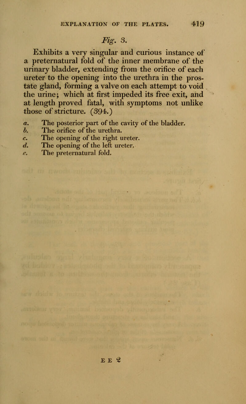 Fig. 3. Exhibits a very singular and curious instance of a preternatural fold of the inner membrane of the urinary bladder, extending from the orifice of each ureter to the opening into the urethra in the pros- tate gland, forming a valve on each attempt to void the urine; which at first impeded its free exit, and at length proved fatal, with symptoms not unlike those of stricture. (394.) a. The posterior part of the cavity of the bladder. b. The orifice of the urethra. c. The opening of the right ureter. d. The opening of the left ureter. e. The preternatural fold. EE^