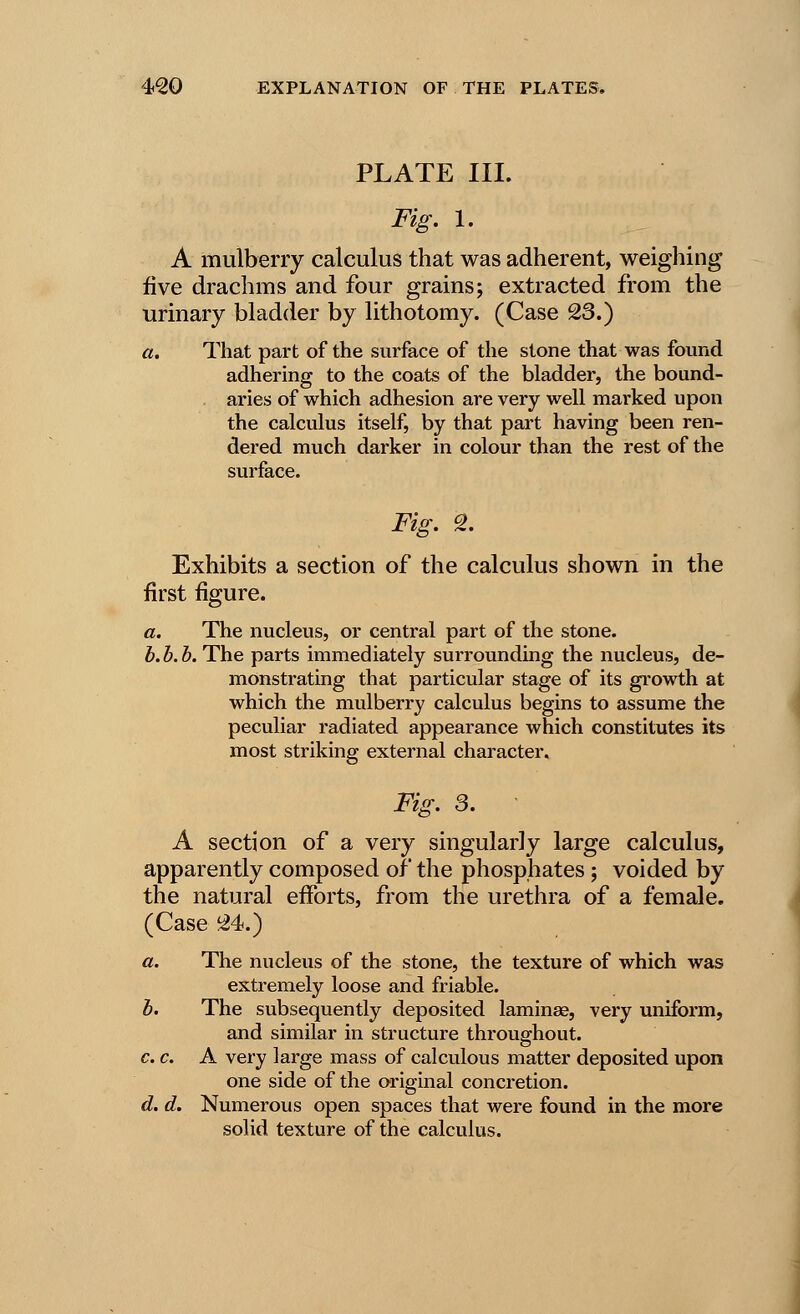 PLATE III. Fig. 1. A mulberry calculus that was adherent, weighing five drachms and four grains; extracted from the urinary bladder by lithotomy. (Case 23.) a. That part of the surface of the stone that was found adhering to the coats of the bladder, the bound- aries of which adhesion are very well marked upon the calculus itself, by that part having been ren- dered much darker in colour than the rest of the surface. Fig. 2. Exhibits a section of the calculus shown in the first figure. a. The nucleus, or central part of the stone. b.b.b. The parts immediately surrounding the nucleus, de- monstrating that particular stage of its growth at which the mulberry calculus begins to assume the peculiar radiated appearance which constitutes its most striking external character. Fig. 3. A section of a very singularly large calculus, apparently composed of the phosphates ; voided by the natural efforts, from the urethra of a female. (Case 24.) a. The nucleus of the stone, the texture of which was extremely loose and friable. b. The subsequently deposited laminae, very uniform, and similar in structure throughout. c. c. A very large mass of calculous matter deposited upon one side of the original concretion. d. d. Numerous open spaces that were found in the more solid texture of the calculus.