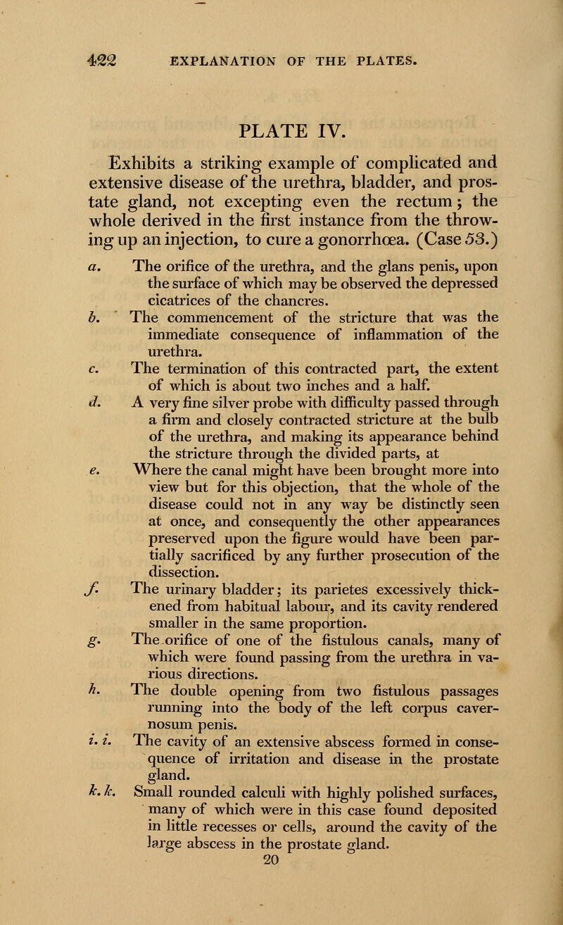 PLATE IV. Exhibits a striking example of complicated and extensive disease of the urethra, bladder, and pros- tate gland, not excepting even the rectum; the whole derived in the first instance from the throw- ing up an injection, to cure a gonorrhoea. (Case .53.) a. The orifice of the urethra, and the glans penis, upon the surface of which may be observed the depressed cicatrices of the chancres. b. The commencement of the stricture that was the immediate consequence of inflammation of the urethra. c. The termination of this contracted part, the extent of which is about two inches and a half. d. A very fine silver probe with difficulty passed through a firm and closely contracted stricture at the bulb of the urethra, and making its appearance behind the stricture through the divided parts, at e. Where the canal might have been brought more into view but for this objection, that the whole of the disease could not in any way be distinctly seen at once, and consequently the other appearances preserved upon the figure would have been par- tially sacrificed by any further prosecution of the dissection. J. The urinary bladder; its parietes excessively thick- ened from habitual labour, and its cavity rendered smaller in the same proportion. g. The orifice of one of the fistulous canals, many of which were found passing from the urethra in va- rious directions. h. The double opening from two fistulous passages running into the body of the left corpus caver- nosum penis. i. i. The cavity of an extensive abscess formed in conse- quence of irritation and disease in the prostate gland. k. k. Small rounded calculi with highly polished surfaces, many of which were in this case found deposited in little recesses or cells, around the cavity of the large abscess in the prostate gland. 20