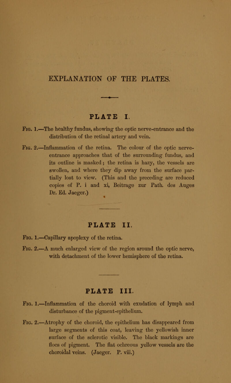 EXPLANATION OF THE PLATES. PLATE I. Fig. 1.—The healthy fundus, showing the optic nerve-entrance and the distribution of the retinal artery and vein. Fig. 2.—Inflammation of the retina. The colour of the optic nerve- entrance approaches that of the surrounding fundus, and its outline is masked; the retina is hazy, the vessels are swollen, and where they dip away from the surface par- tially lost to view. (This and the preceding are reduced copies of P. i and xi, Beitrage zur Path, des Auges Dr. Ed. Jaeger.) PLATE II. Fig. 1.—Capillary apoplexy of the retina. Fig. 2.—A much enlarged view of the region around the optic nerve, with detachment of the lower hemisphere of the retina. PLATE III. Fig. 1.—Inflammation of the choroid with exudation of lymph and disturbance of the pigment-epithelium. Fig. 2.—Atrophy of the choroid, the epithelium has disappeared from large segments of this coat, leaving the yellowish inner surface of the sclerotic visible. The black markings are floes of pigment. The flat ochreous yellow vessels are the choroidal veins. (Jaeger. P. viii.)