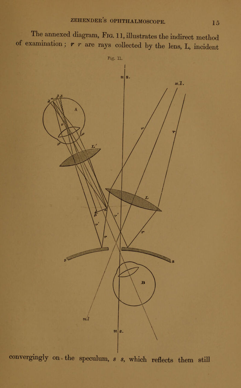 15 The annexed diagram, Fig. 11, illustrates the indirect method of examination; r r are rays collected by the lens, L, incident Fig. 11. convergingly on the speculum, s s, which reflects them still