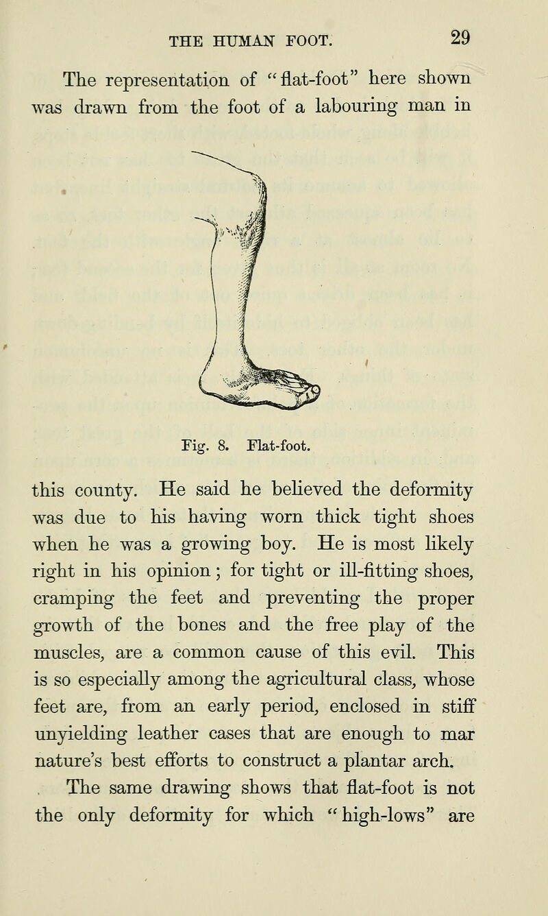 The representation of flat-foot here shown was drawn from the foot of a labouring man in Fig. 8. Flat-foot. this county. He said he believed the deformity was due to his having worn thick tight shoes when he was a growing boy. He is most hkely right in his opinion; for tight or ill-fitting shoes, cramping the feet and preventing the proper growth of the bones and the free play of the muscles, are a common cause of this evil. This is so especially among the agricultural class, whose feet are, from an early period, enclosed in stiff unyielding leather cases that are enough to mar nature's best efforts to construct a plantar arch. The same drawing shows that flat-foot is not the only deformity for which high-lows are