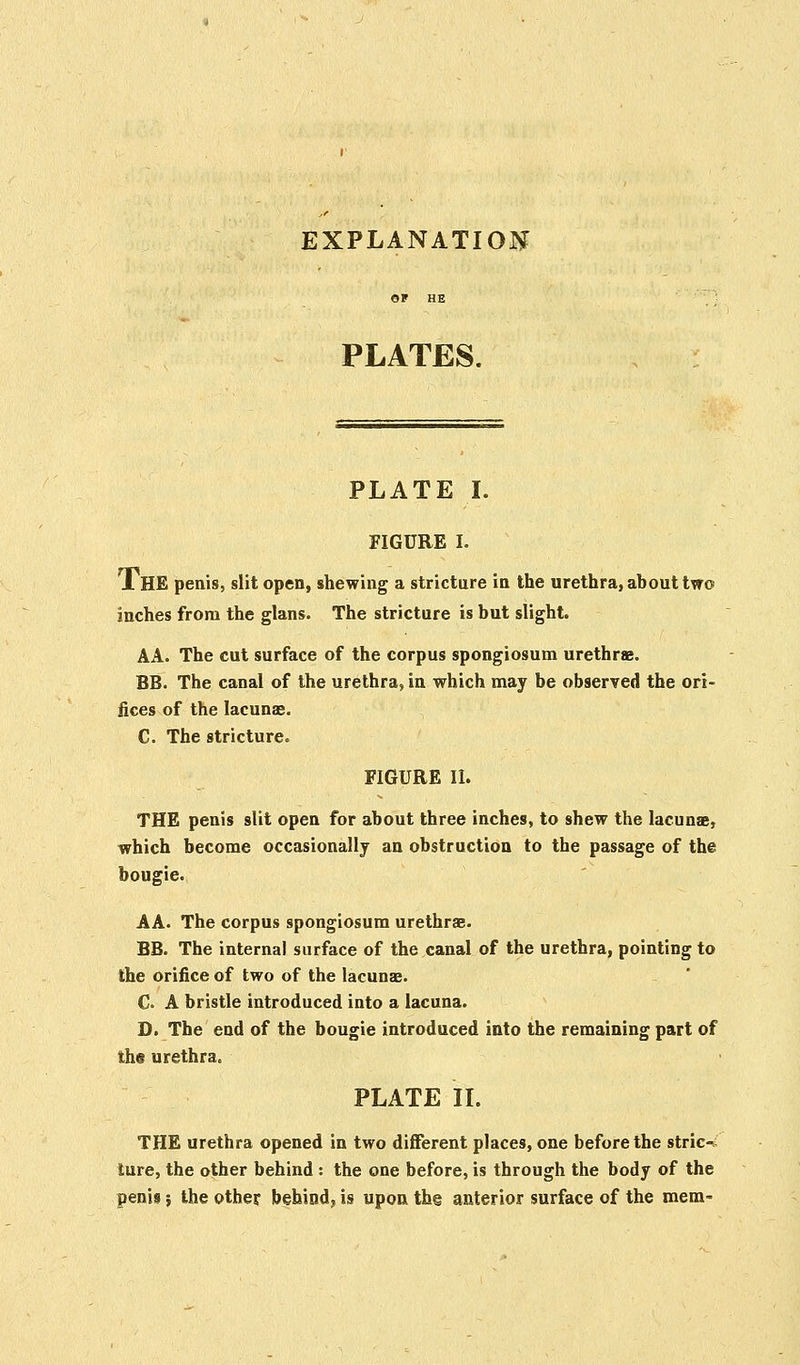 EXPLANATION PLATES. PLATE I. FIGURE I. J. HE penis, slit open, shewing a stricture in the urethra, about two inches from the glans. The stricture is but slight. AA. The cut surface of the corpus spongiosum urethra?. BB. The canal of the urethra, in which may be observed the ori- fices of the lacunas. C. The stricture. FIGURE II. THE penis slit open for about three inches, to shew the lacuna:, which become occasionally an obstruction to the passage of the bougie. AA. The corpus spongiosum urethras. BB. The internal surface of the canal of the urethra, pointing to the orifice of two of the lacunae. C. A bristle introduced into a lacuna. D. The end of the bougie introduced into the remaining part of the urethra. PLATE II. THE urethra opened in two different places, one before the strict lure, the other behind : the one before, is through the body of the penis j the other behind, is upon the anterior surface of the mem-