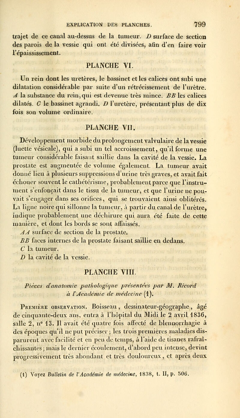trajet de ce canal au-dessus de la tumeur. D surface de section des parois de la vessie qui ont été divisées, afln d'en faire voir l'épaississement. PLANCHE YI. Un rein dont les uretères, le bassinet et les calices ont subi une dilatation considérable par suite d'un rétrécissement de l'urètre. A la substance du rein,qui est devenue très mince. BB les calices dilatés. C le bassinet agrandi. D l'uretère, présentant plus de dix fois son volume ordinaire. PLANCHE VII. Développement morbide du prolongement valvulaire de la vessie (luette vésicale), qui a subi un tel accroissement, qu'il forme une tumeur considérable faisant saillie dans la cavité de la vessie. La prostate est augmentée de volume également. La tumeur avait donné lieu à plusieurs suppressions d'urine très graves, et avait fait échouer souvent le cathétérisme, probablement parce que l'instru- ment s'enfonçait dans le tissu de la tumeur, et que l'ui'ine ne pou- vait s'engager dans ses orifices, qui se trouvaient ainsi oblitérés. La ligne noire qui sillonne la tumeur, à partir du canal de l'urètre, indique probablement une déchirure qui aura été faite de cette manière, et dont les bords se sont affaissés. AA surface de section de la prostate. BB faces internes de la prostate faisant saillie en dedans. C la tumeur. D la cavité de la vessie. PLANCHE YIII. Pièces danatomie pathologique présentées par M. Ricard à tAcadémie de médecine (1). Première observation. Boisseau, dessinateur-géographe, âgé de cinquante-deux ans, entra à l'hôpital du Midi le 2 avril 1836, salle 2, n 13. Il avait été quatre fois affecté de blennorrhagie à des époques qu'il ne put préciser ; les trois premières maladies dis- parurent avec facilité et en peu de temps, à l'aide de tisanes rafraî- chissantes ; mais le dernier écoulement, d'abord peu intense, devint progressivement très abondant et très douloureux, et après deux (1) Voyez Bullelin de l'Académie de médecine, 1838, t. II, p. 506.