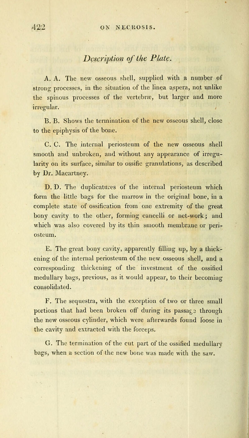 Description of the Plate. A. A. The new osseous shell, supplied with a number of strong processes, in the situation of the linea aspera, not unlike the spinous processes of the vertebree, but larger and more irregular. B. B. Shows the termination of the new osseous shell, close to the epiphysis of the bone. C. C. The internal periosteum of the new osseous shell smooth and unbroken, and without any appearance of irregu- larity on its surface, similar to ossific granulations, as described by Dr. Macartney. D. D. The duplicatures of the internal periosteum which form the little bags for the marrow in the original bone, in a complete state of ossification from one extremity of the great bony cavity to the other, forming cancelli or net-work; and which was also covered by its thin smooth membrane or peri- osteum. E. The great bony cavity, apparently filling up, by a thick- ening of the internal periosteum of the new osseous shell, and a corresponding thickening of the investment of the ossified medullary bags, previous, as it would appear, to their becoming consolidated. F. The sequestra, with the exception of two or three small portions that had been broken off during its passags through the new osseous cylinder, which were afterwards found loose in the cavity and extracted with the forceps. G. The termination of the cut part of the ossified medullary bags, when a section of the new bone was made with the saw.