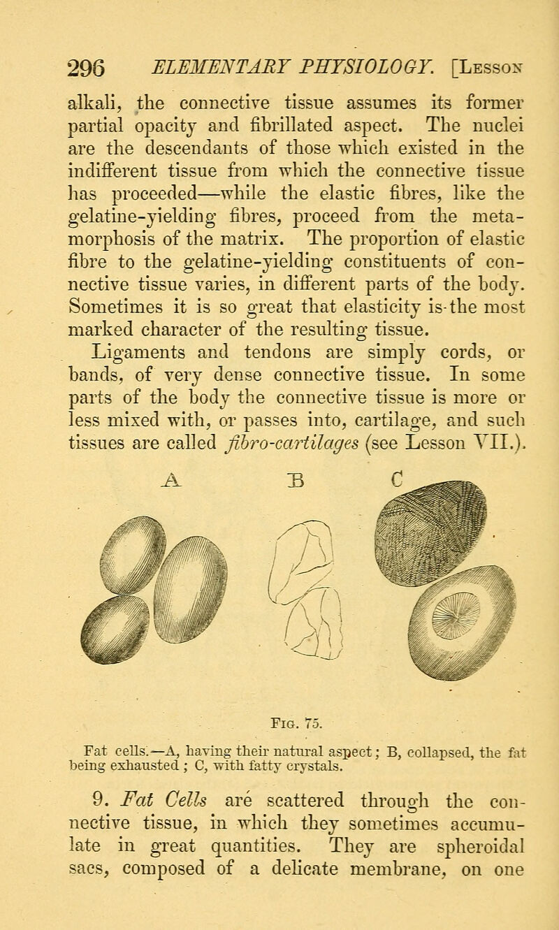 alkali, the connective tissue assumes its former partial opacity and fibrillated aspect. The nuclei are the descendants of those which existed in the indifferent tissue from which the connective tissue has proceeded—while the elastic fibres, like the gelatine-yielding fibres, proceed from the meta- morphosis of the matrix. The proportion of elastic fibre to the gelatine-yielding constituents of con- nective tissue varies, in different parts of the body. Sometimes it is so great that elasticity is-the most marked character of the resulting tissue. Ligaments and tendons are simply cords, or bands, of very dense connective tissue. In some parts of the body the connective tissue is more or less mixed with, or passes into, cartilage, and such tissues are called fibro-cartilages (see Lesson YIL). Fig. 75. Fat cells.—A, having their natural aspect; B, collapsed, the fot being exhausted ; C, with fatty crystals. 9. Fat Cells are scattered througli the con- nective tissue, in which they sometimes accumu- late in great quantities. They are spheroidal sacs, composed of a delicate membrane, on one