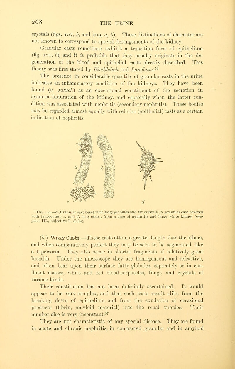 crystals (figs. 107, b, and 109, a, b). These distinctions of character are not known to correspond to special derangements of the kidney. Granular casts sometimes exhibit a transition form of epithelium (fig. 101, b), and it is probable that they usually originate in the de- generation of the blood and epithelial casts already described. This theory was first stated by Rindfleisch and Langhmis.56 The presence in considerable quantity of granular casts in the urine indicates an inflammatory condition of the kidneys. They have been found (v. Jahsch) as an exceptional constituent of the secretion in cyanotic induration of the kidney, and especially when the latter con- dition was associated with nephritis (secondary nephritis). These bodies may be regarded almost equally with cellular (epithelial) casts as a certain indication of nephritis. f'PiG. 109.— agranular cast beset with fatty globules and fat crystals ; b. granular cast covered with leucocytes ; c. and d. fatty casts ; from a case of nephritis and large white kidney (eye- piece III., objective F, Zeiss). (b.) Waxy Casts.—These casts attain a greater length than the others, and when comparatively perfect they may be seen to be segmented like a tapeworm. They also occur in shorter fragments of relatively great breadth. Under the microscope they are homogeneous and refractive, and often bear upon their surface fatty globules, separately or in con- fluent masses, white and red blood-corpuscles, fungi, and crystals of various kinds. Their constitution has not been definitely ascertained. It would appear to be very complex, and that such casts result alike from the breaking down of epithelium and from the exudation of occasional products (fibrin, amyloid material) into the renal tubules. Their number also is very inconstant.57 They are not characteristic of any special disease. They are found in acute and chronic nephritis, in contracted granular and in amyloid