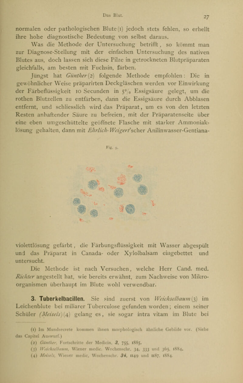 normalen oder pathologischen Blute(i) jedoch stets fehlen, so erhellt ihre hohe diagnostische Bedeutung von selbst darai Was die Methode der Untersuchung betrifft . s nint man zur Diagnose-Stellung mit der einfachen Untersuchung des nativen Blut -. doch lassen sich diese Pilze in getrockneten Blutpräparaten gleichfalls, am besten mit Fuchsin, färben. Jüngst hat Günther 2 ioV^udc Methode empfohlen : Die in gewöhnlicher Weise präparirten Deckgläschen werden vor Einwirkung der Färbeflüssigkeit 10 Secunden in 5 Essigsäure gelegt, um die rothen Blutzellen zu entfärben, dann die 1. re durch Abblasen entfernt, und schliesslich wird das Präparat, um es von den letzten 5ten anhaftender Säure zu befreien, mit der Präparatenseite über eine eben um geschüttelte fifnete Flasche mit starker Ammoniak? -en, dann mit EJirlick-W 'seher Anilin was ser-Gentiana- <&.> «V'-i violettlösung gefärbt, die Färbungsflüssigkeit mit Wasser abgespült und das Präparat in Canada- oder Xylolbalsam eingebettet und untersucht. Die Methode i-t nach Versuchen, welche Herr (and. med. 'i/i-r an I hat, wie bereits erwähnt, zum Nachweise von Mi inismen überhaupt im Blute wohl verwendbar. 3. Tuberkelbaclllen. Sie sind zuerst von Weickselbautn{$\ im Leichenblute bei miliai I bereul funden worden; einem seiner ir intra \ itain im Blute a ähnliche < I das Capitcl A