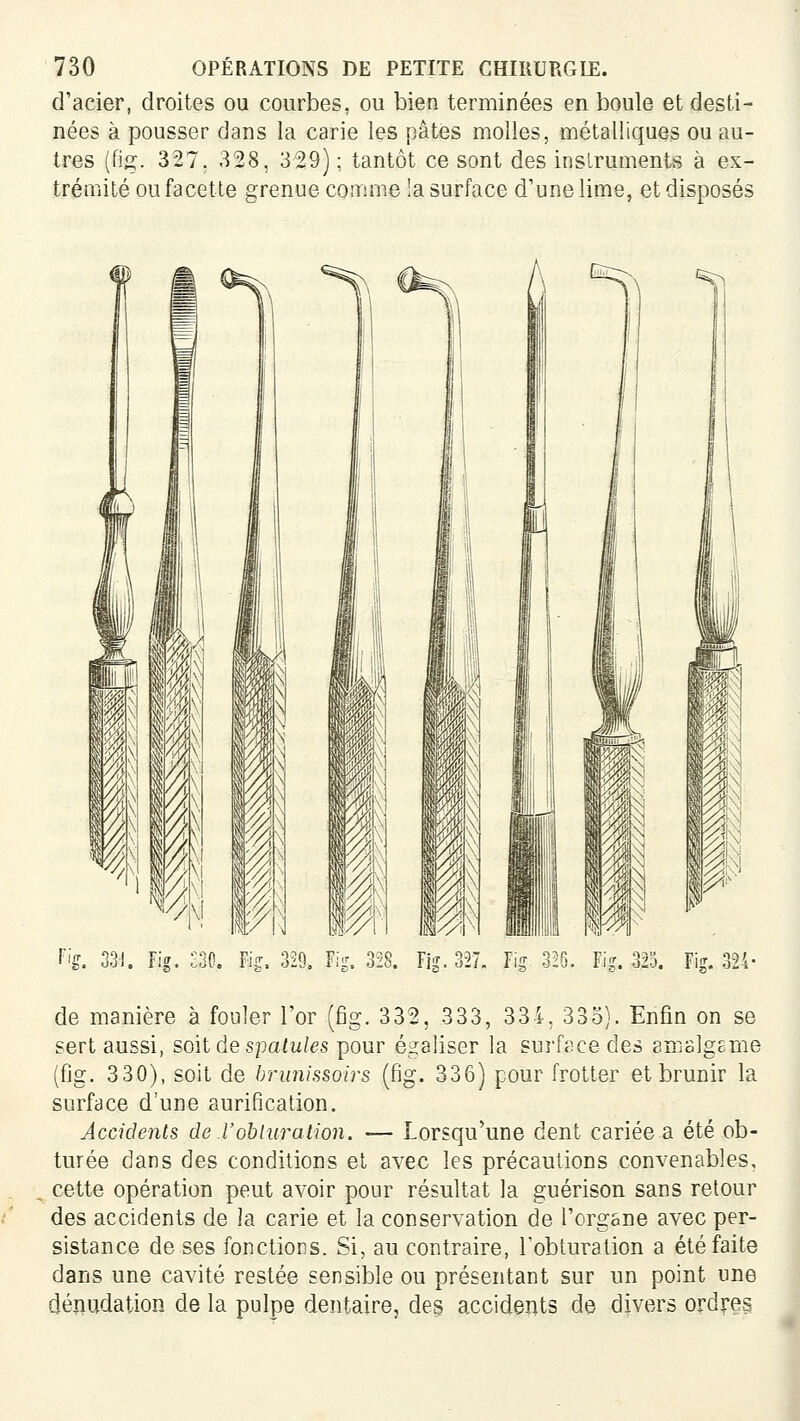 d'acier, droites ou courbes, ou bien terminées en boule et desti- nées à pousser dans la carie les pâtes molles, métalliques ou au- tres (fig. 327. 328, 329) ; tantôt ce sont des instruments à ex- trémité ou facette grenue comme !a surface d'une lime, et disposés '^ ffg. 331. Fig. m> Fig, 329. Fig. 328. Fig. 327. Fig 325. Fig. 325. Fig. 324 de manière à fouler l'or (fig. 332, 333, 334, 335). Enfin on se sert aussi, soit de spaiw/es pour égaliser la surfiicedes amalgcme (fig. 330), soit de brunissoirs (fig. 336) pour frotter et brunir la surface d'une aurification. Accidents de l'obtura lion. — Lorsqu'une dent cariée a été ob- turée dans des conditions et avec les précautions convenables, cette opération peut avoir pour résultat la guérison sans retour des accidents de la carie et la conservation de l'organe avec per- sistance de ses fonctions. Si, au contraire, l'obturation a été faite dans une cavité restée sensible ou présentant sur nn point une dénudation de la pulpe dentaire, des accidents de divers ordres