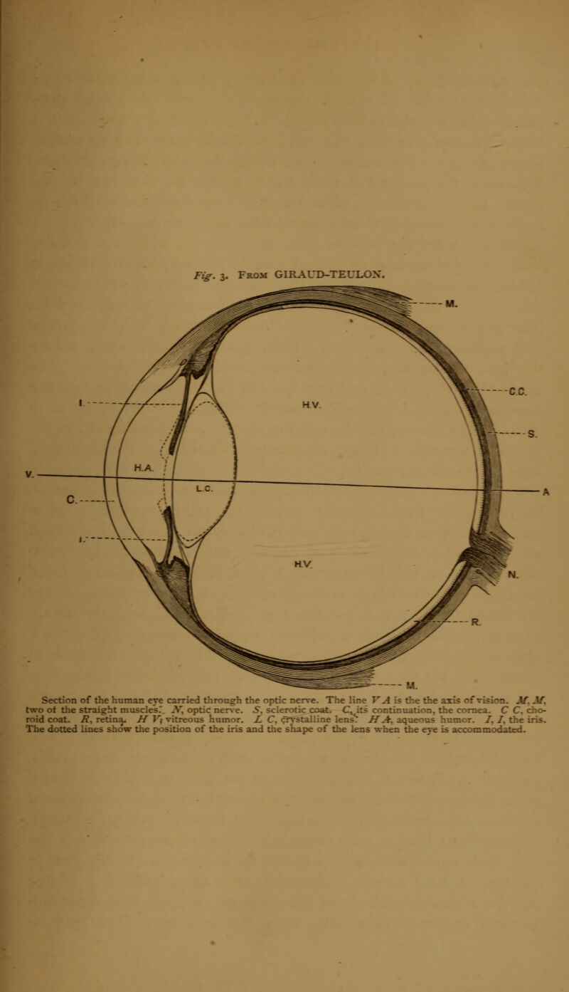 From GIRAUD-TEULOX. — M. Section of the human eye carried through the optic nerve A is the the axis of vision. M, two ot the straight muscles.. ^V, optic nerve, roid coat. R. retina- H V; vitreous humor. The dotted lines show the position of the iris and the shape of the lens when the eye is accommodated. K -.'.erotic coat C-iti continuation, the cornea. C t roid coat. R. retina. H V; vitreous humor. L C. crystalline lens. HA, aqueous humor. /, /. the iris.